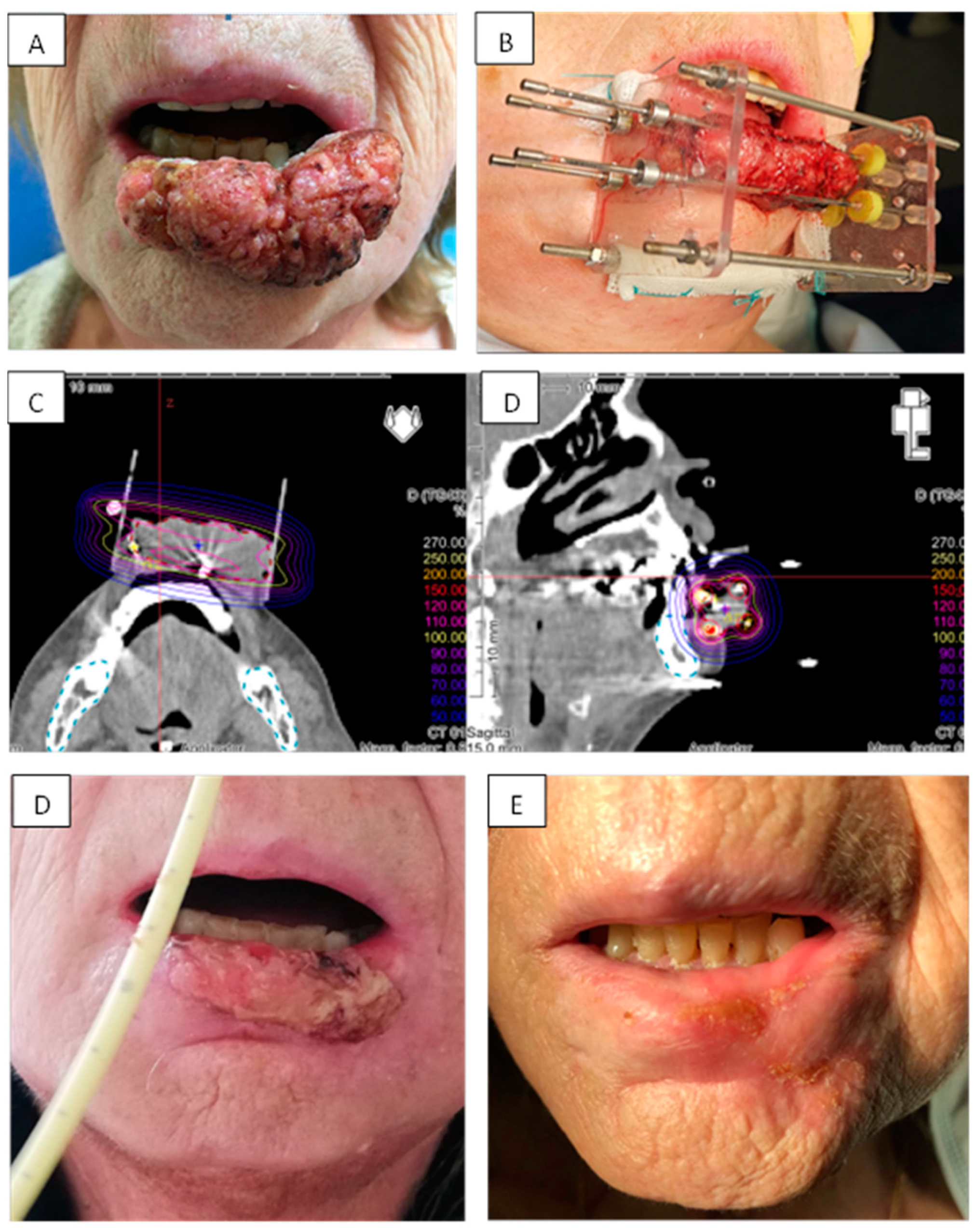 Cancers 13 01387 g002
