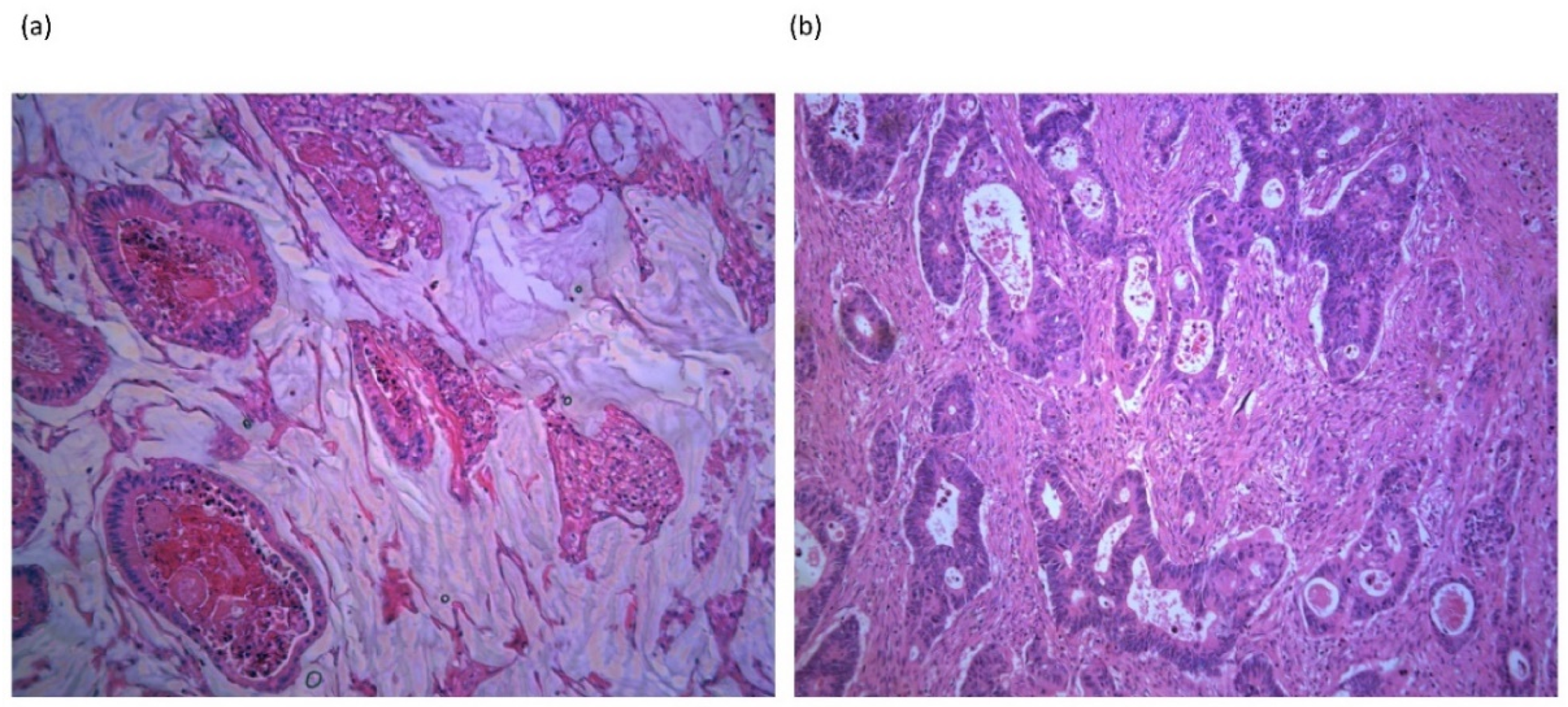 Cancers 13 01389 g001