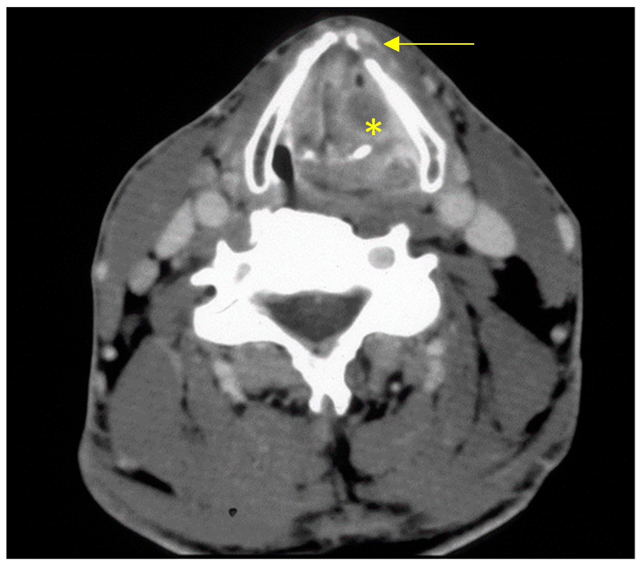 Cancers 13 01405 g001