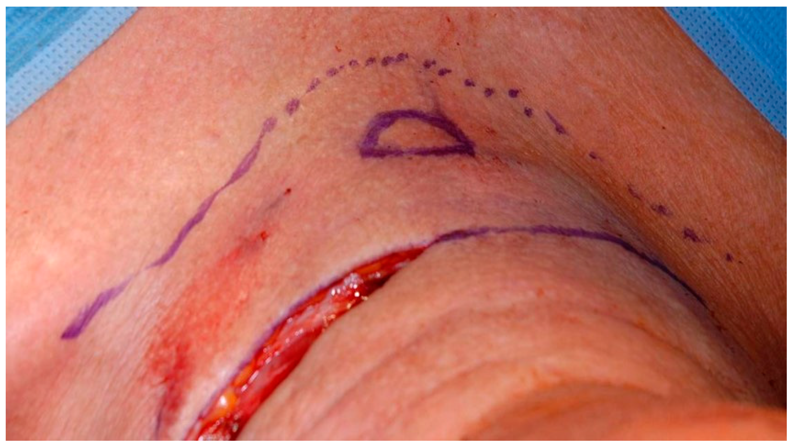 Cancers 13 01405 g002