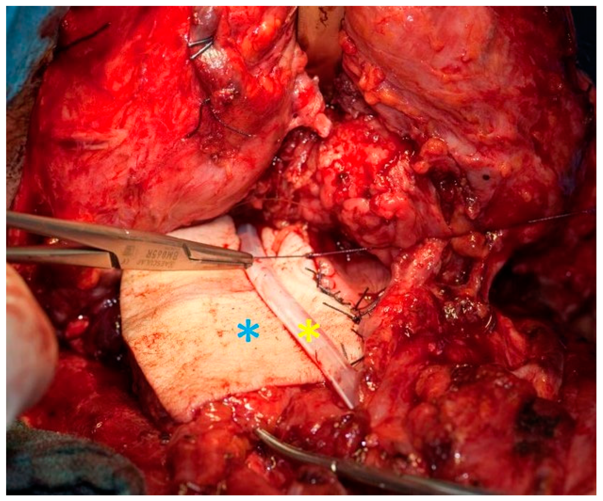 Cancers 13 01405 g003