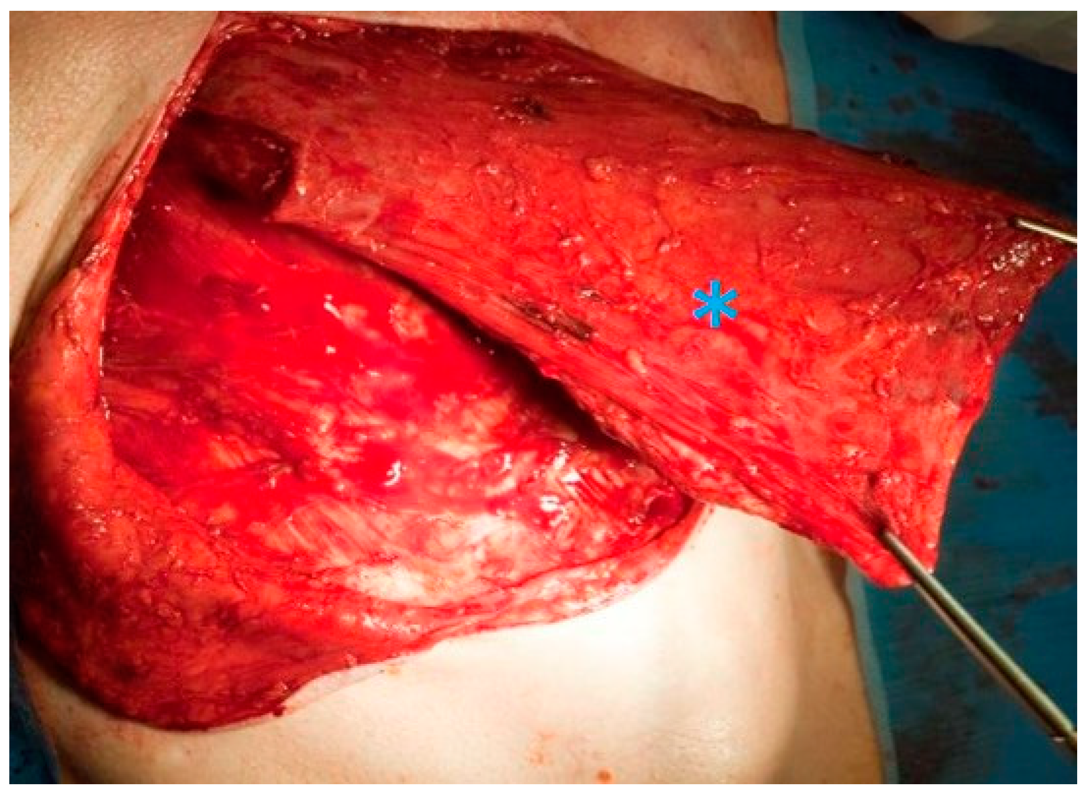 Cancers 13 01405 g004