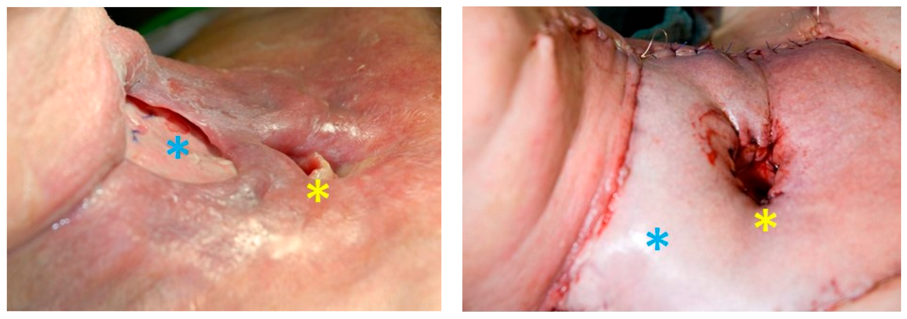 Cancers 13 01405 g005