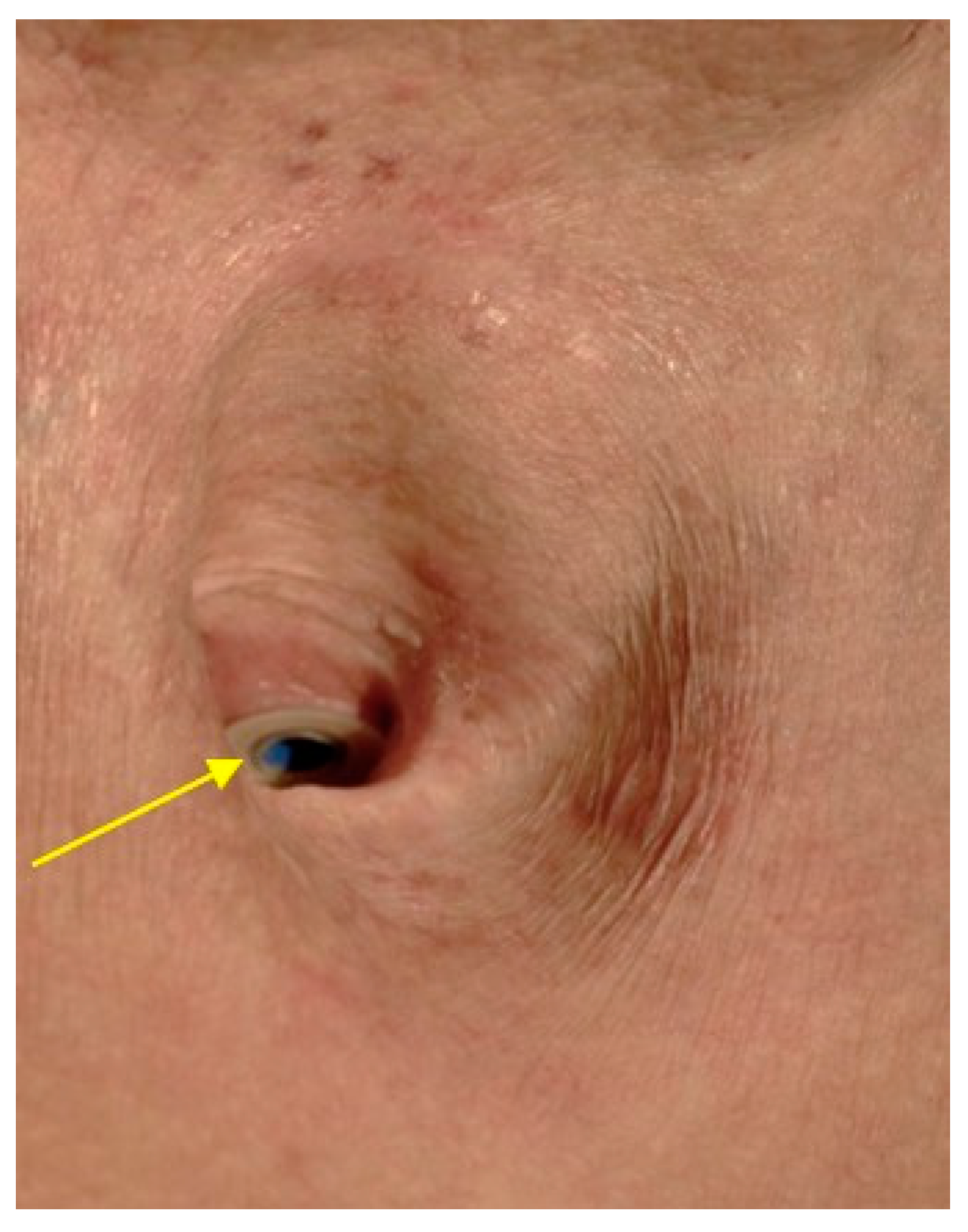 Cancers 13 01405 g006