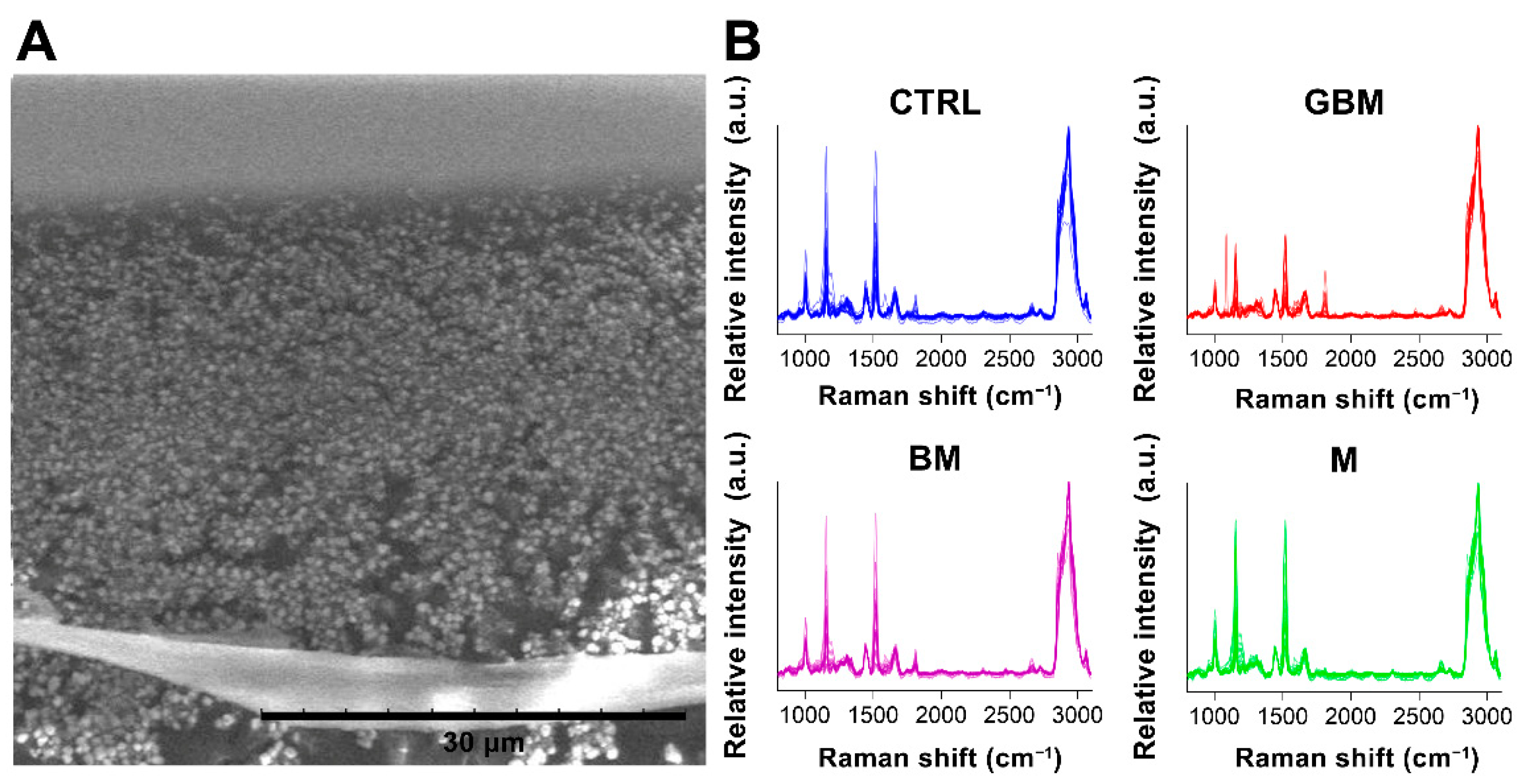 Cancers 13 01407 g003 Cancers 13 01407 g003