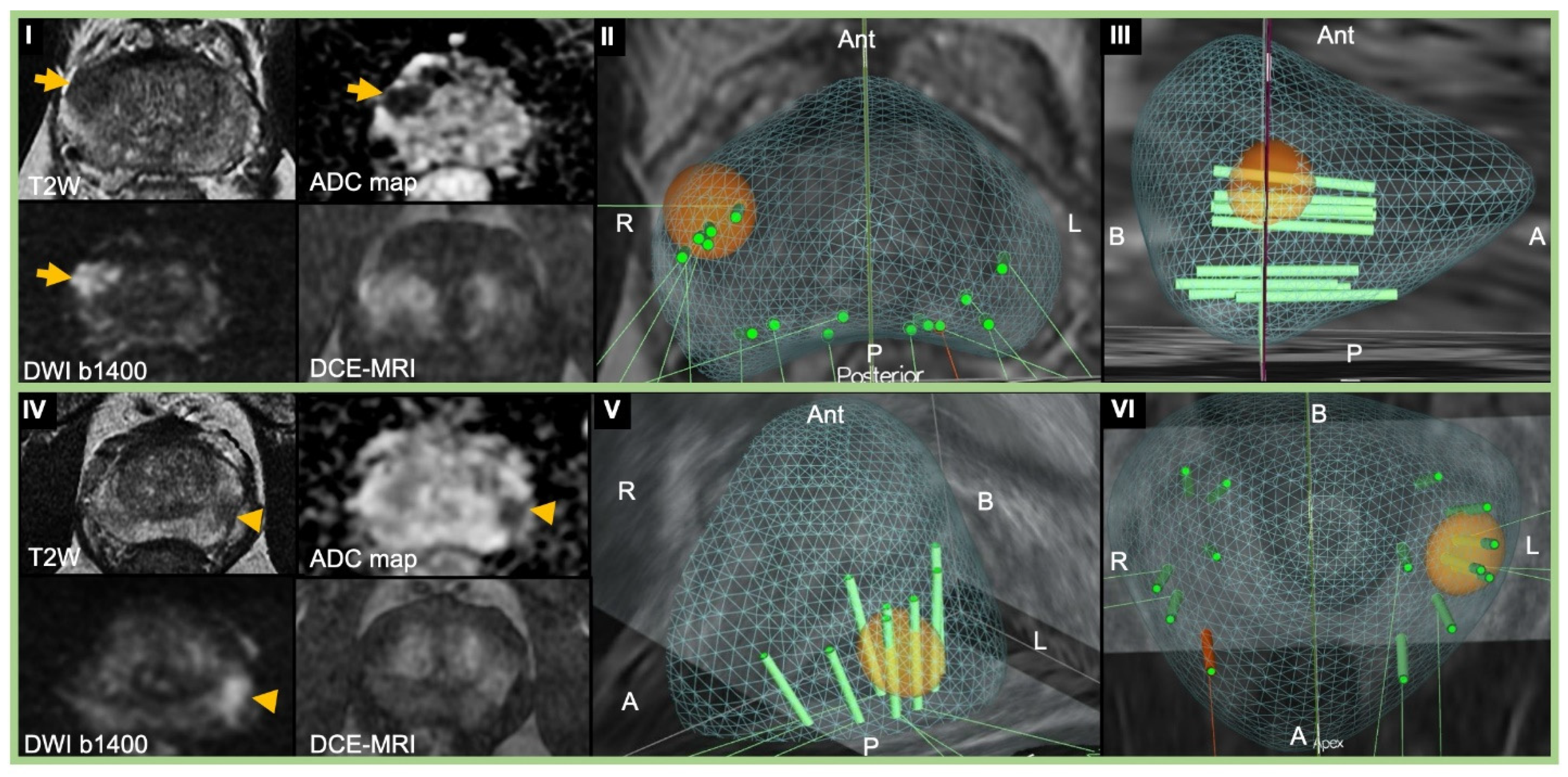 Cancers 13 01449 g001 Cancers 13 01449 g001