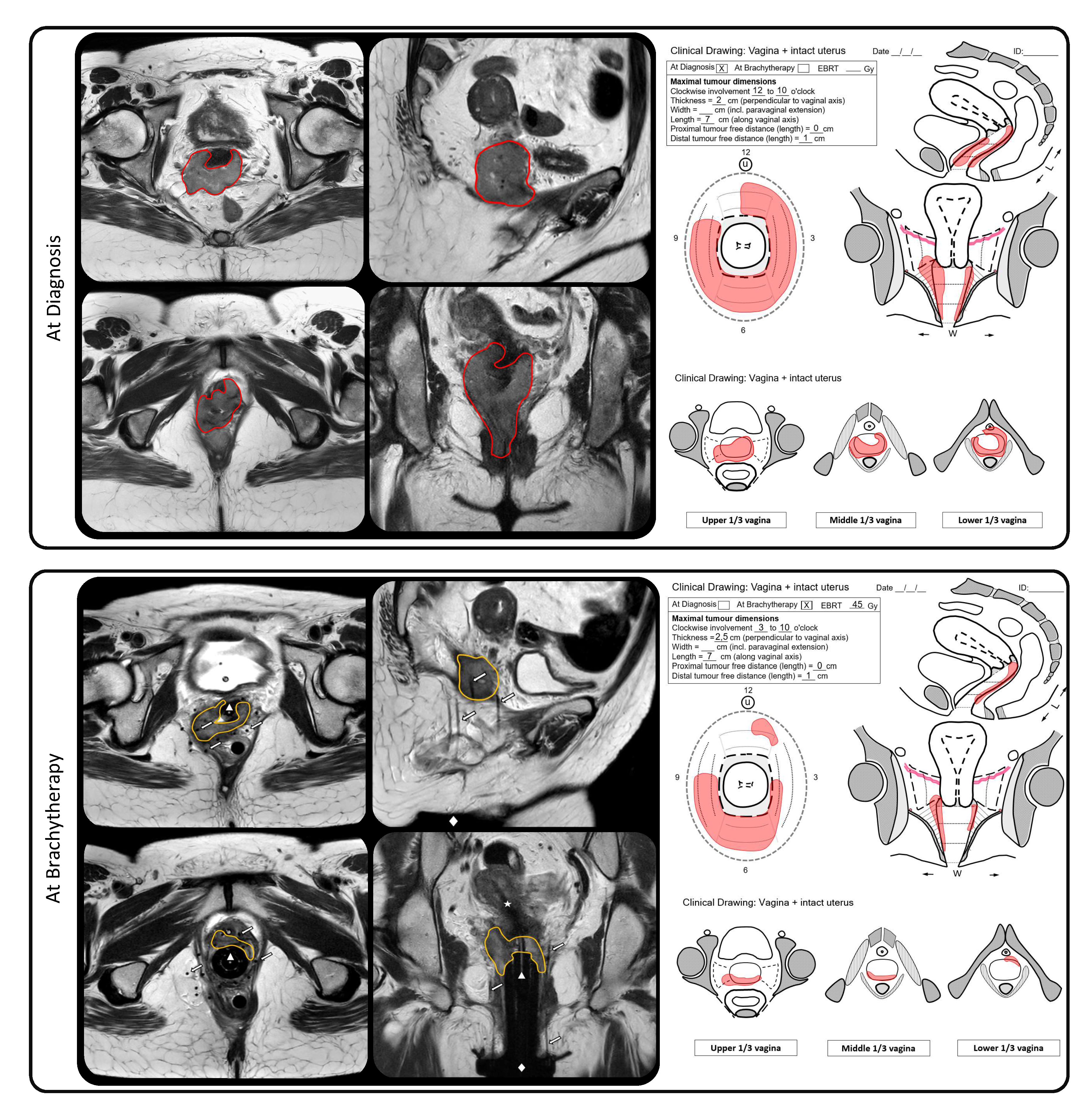 Cancers 13 01459 g001