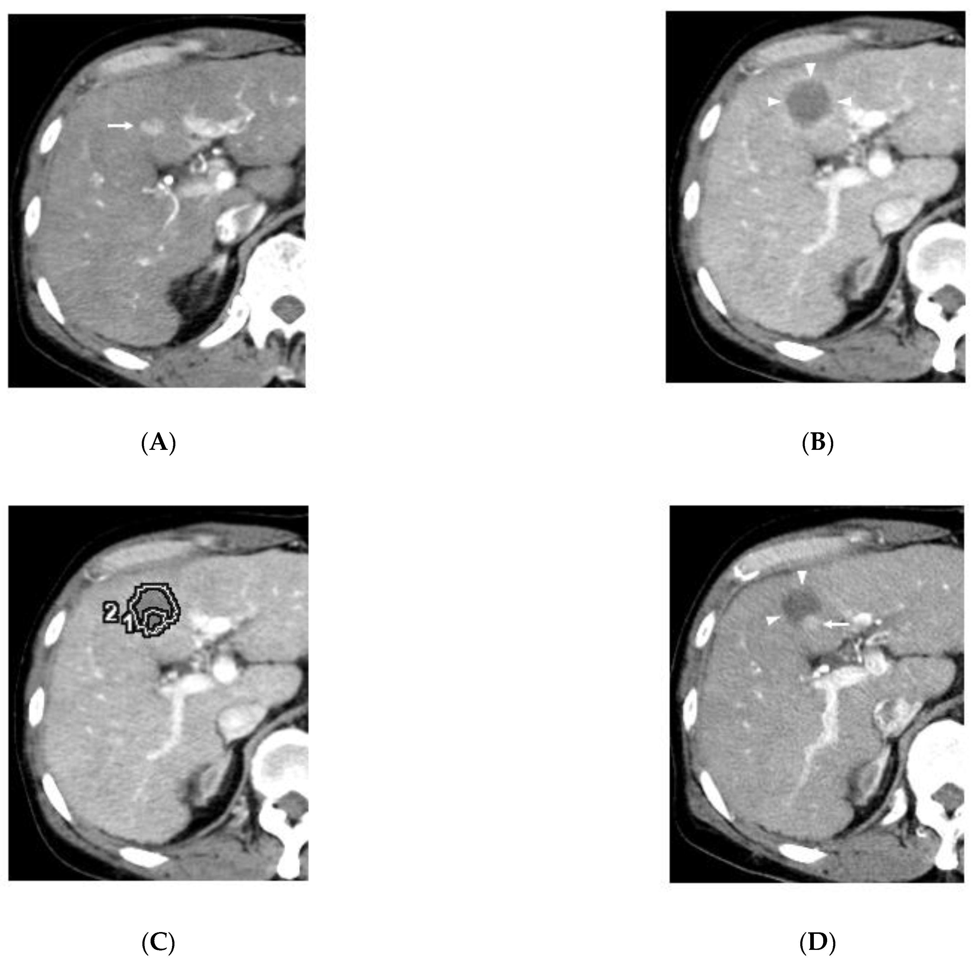 Cancers 13 01460 g003