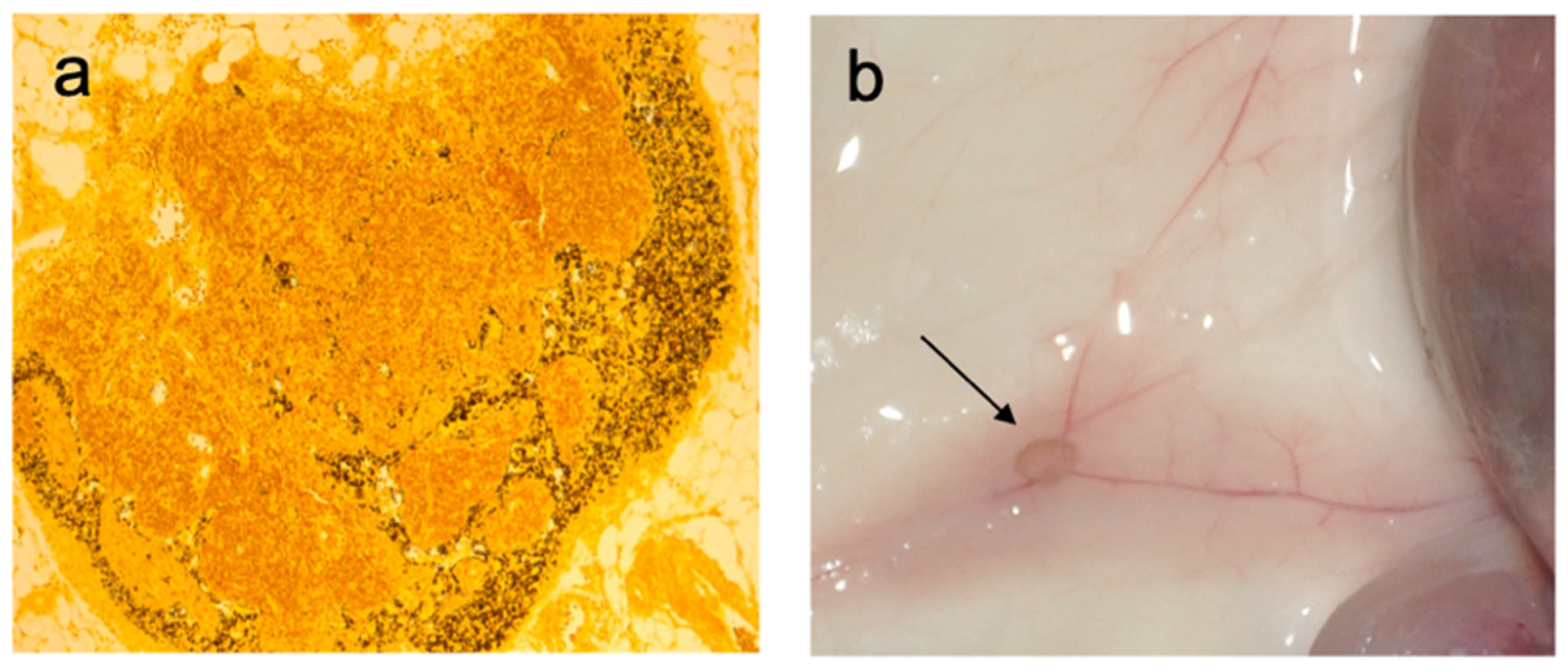 Cancers 13 01463 g003 Cancers 13 01463 g003