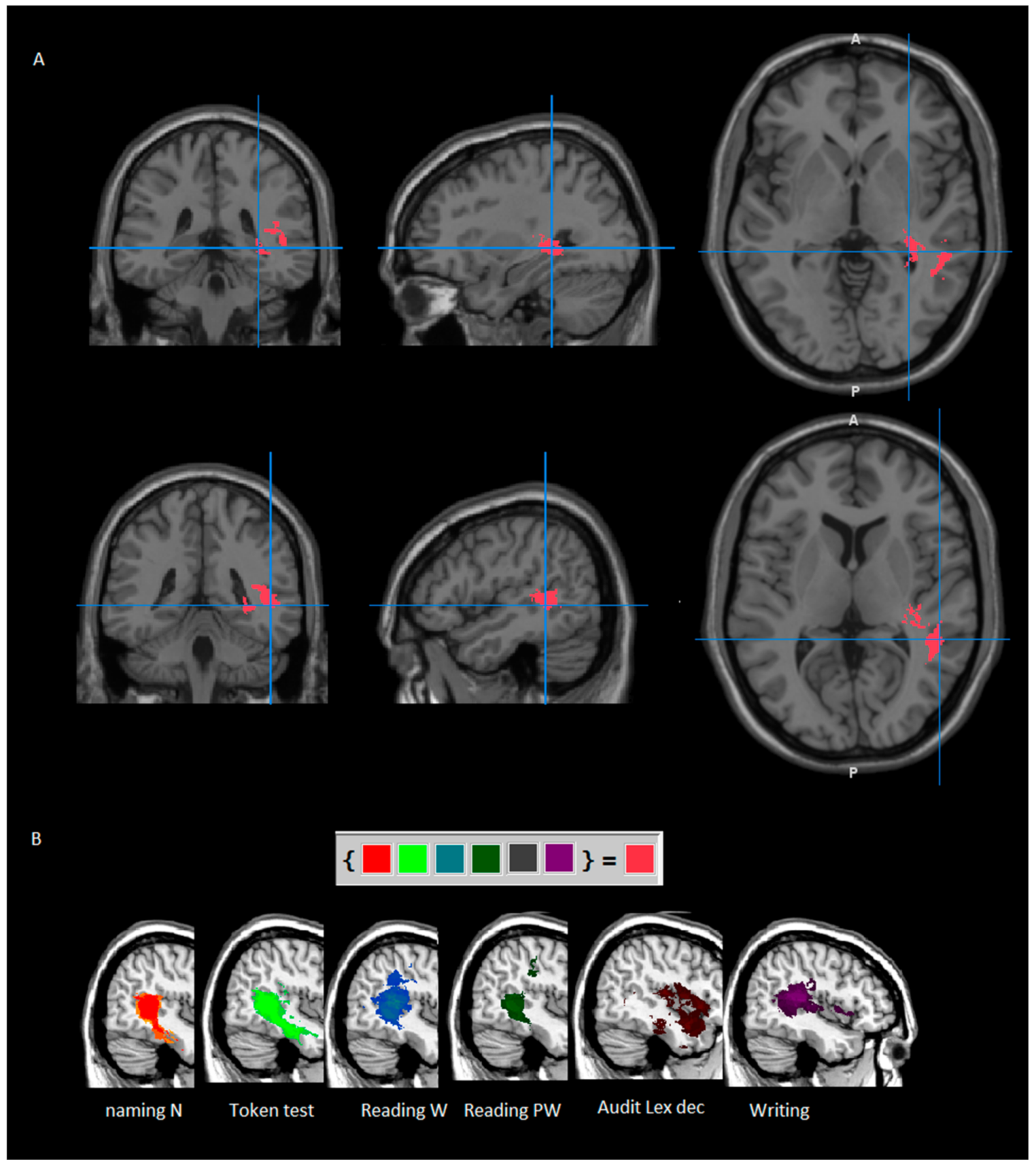 Cancers 13 01467 g003