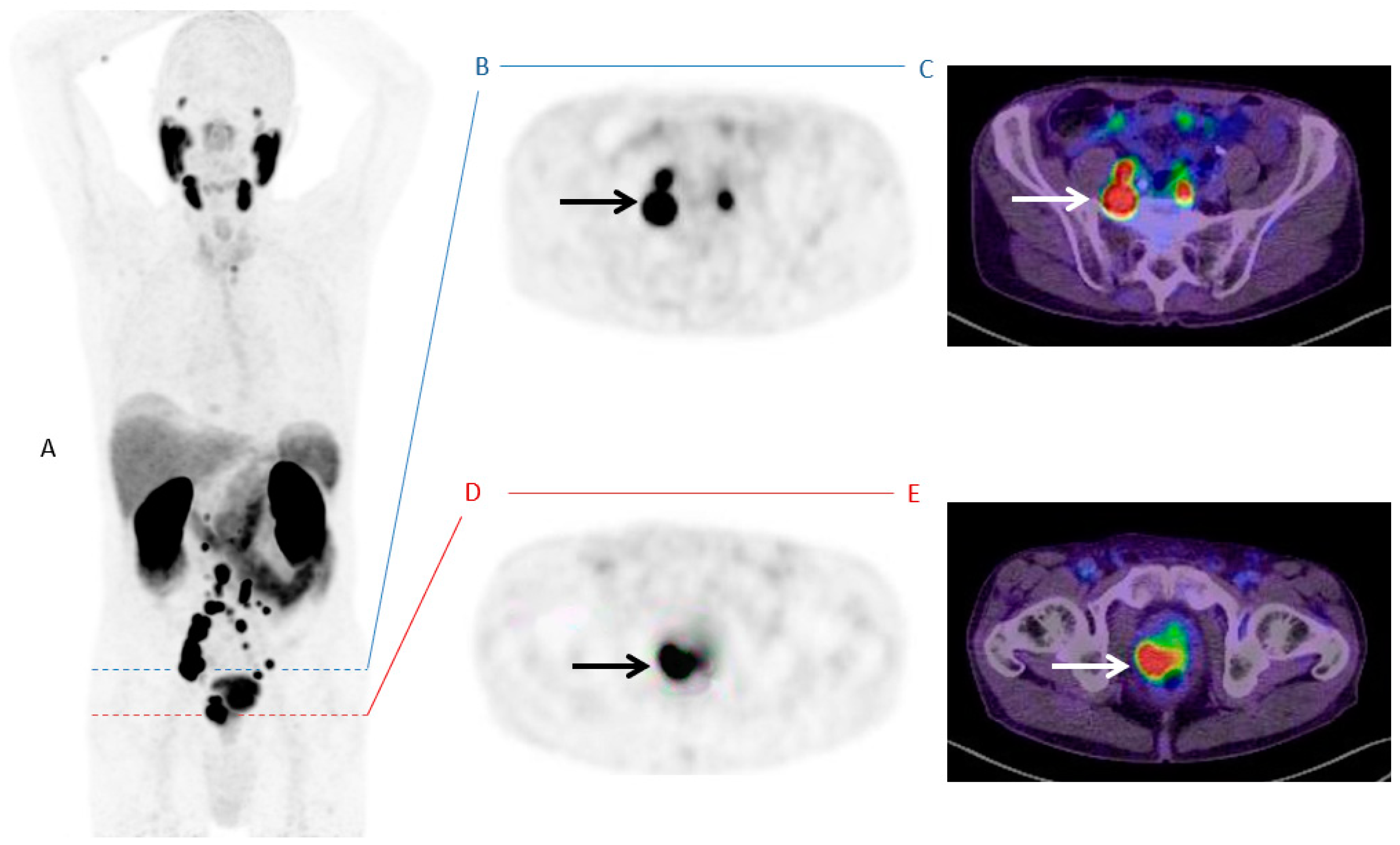 Cancers 13 01508 g003