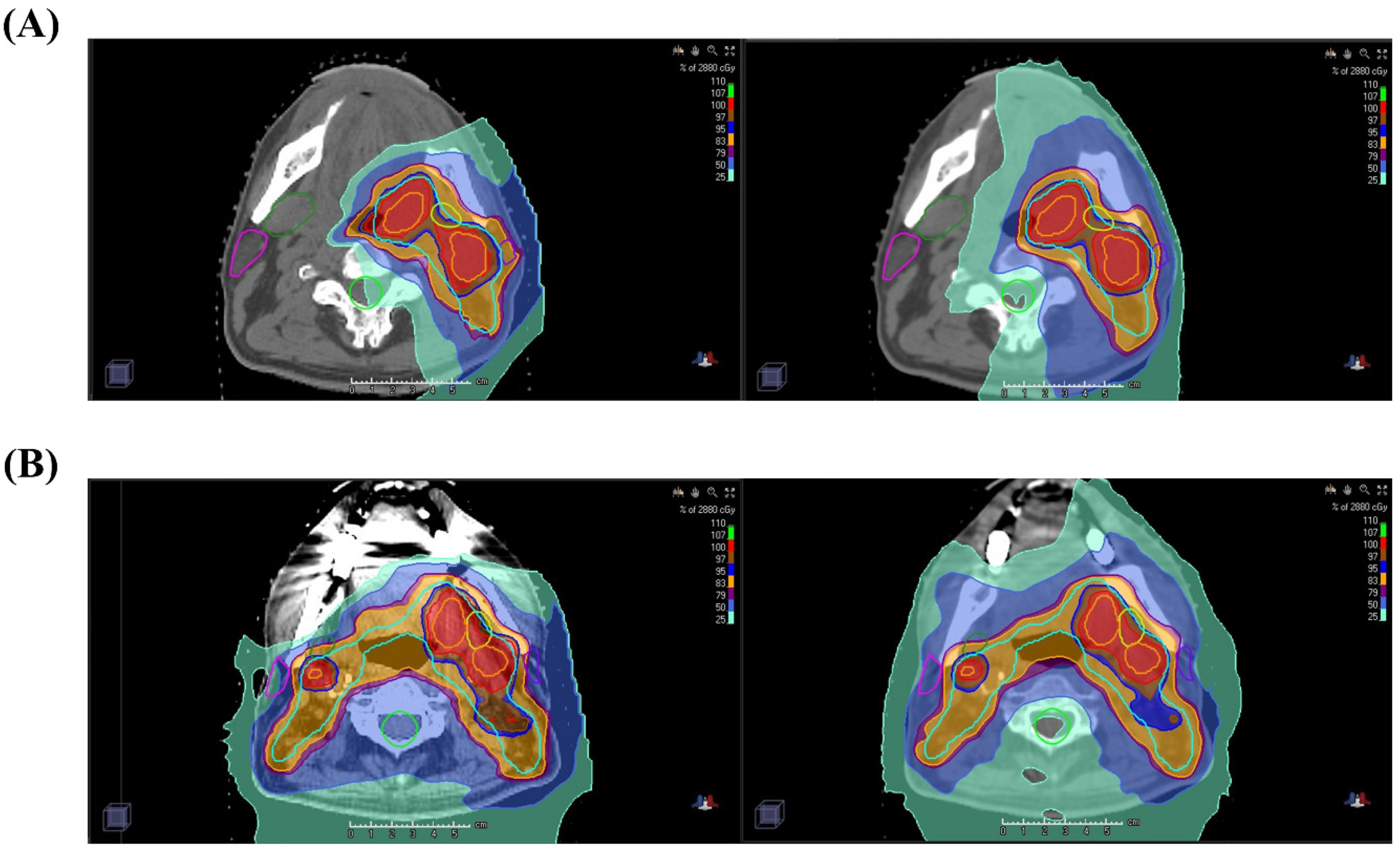 Cancers 13 01549 g003