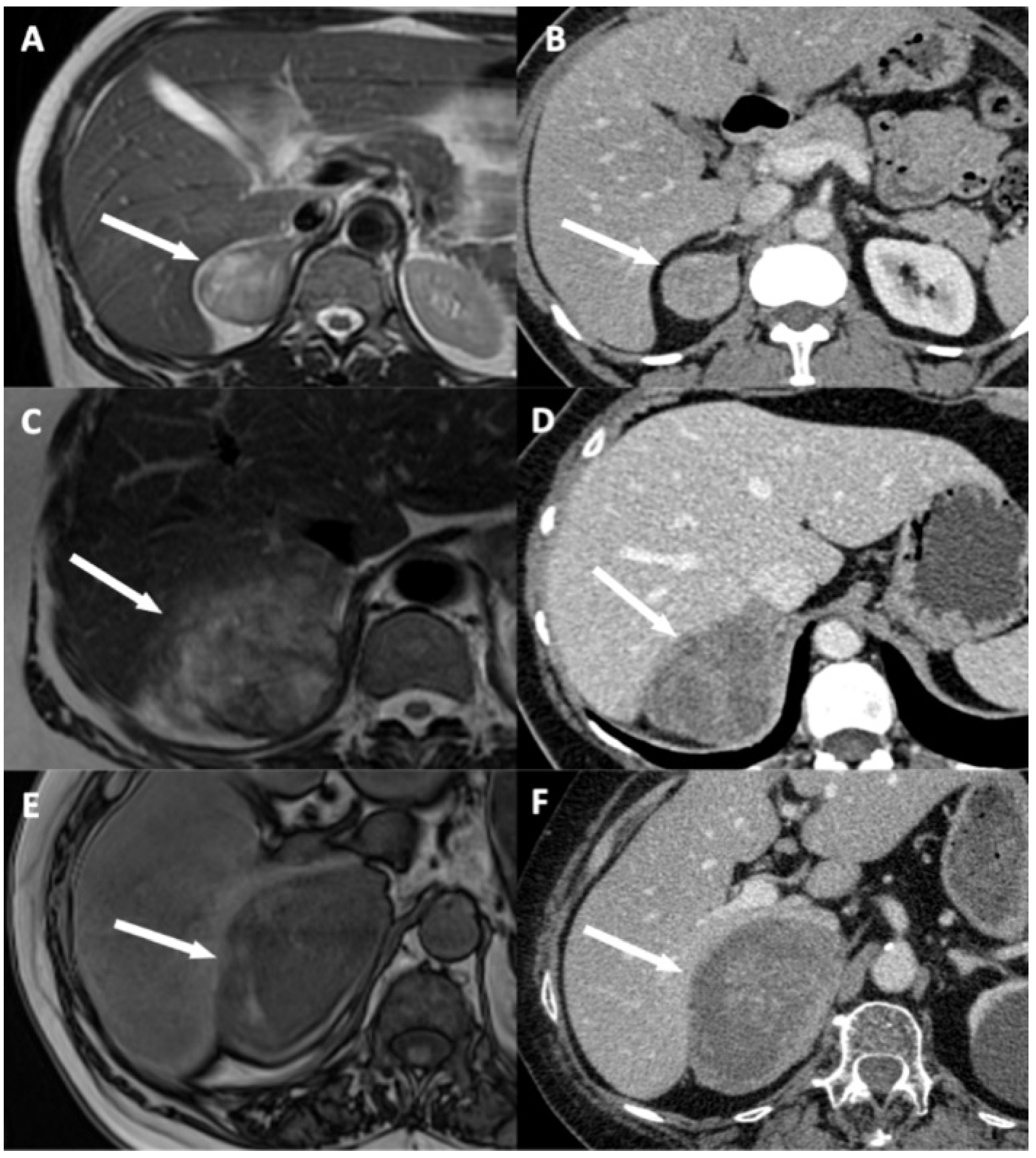 Cancers 13 01603 g003