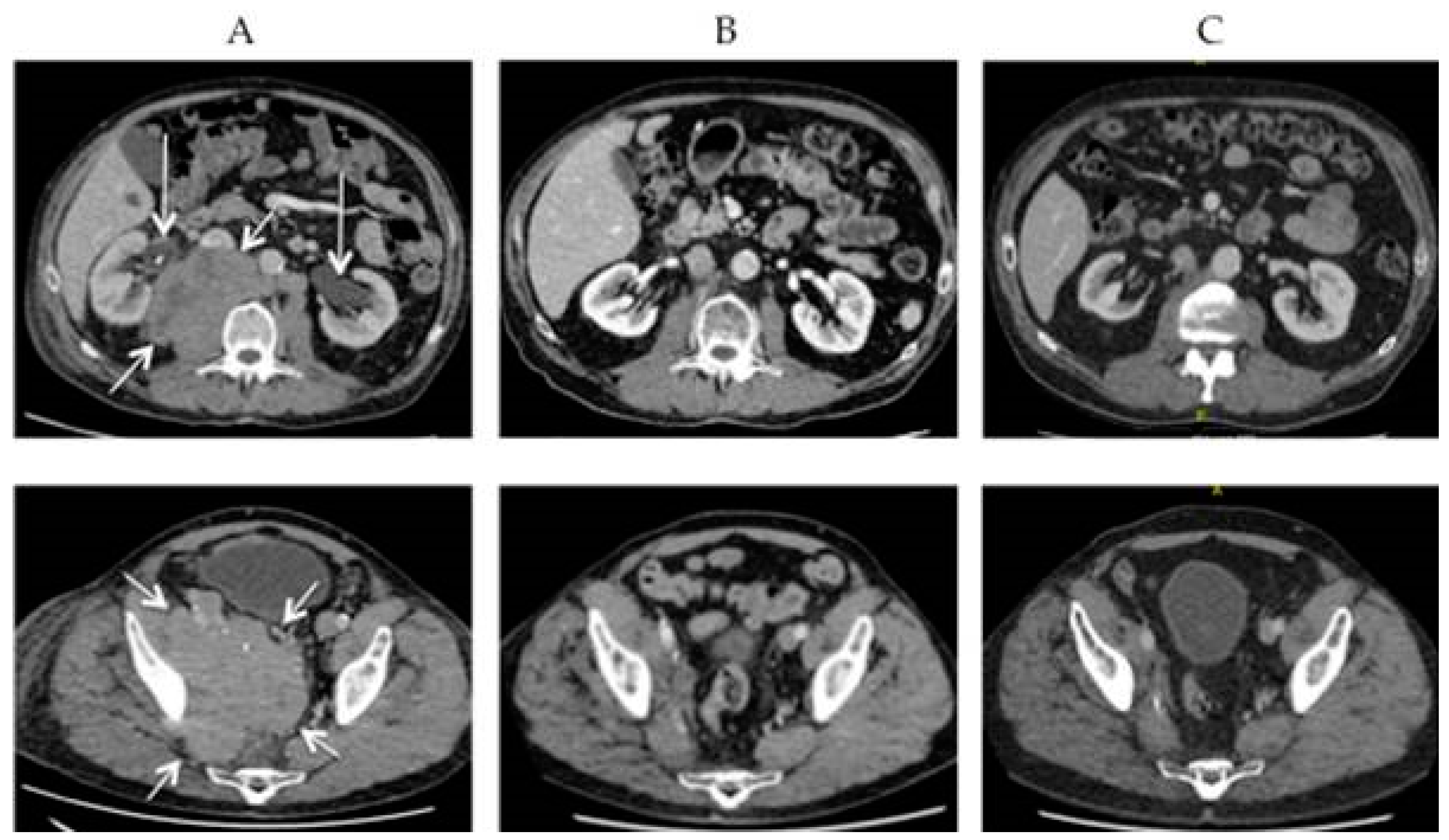 Cancers 13 01614 g002