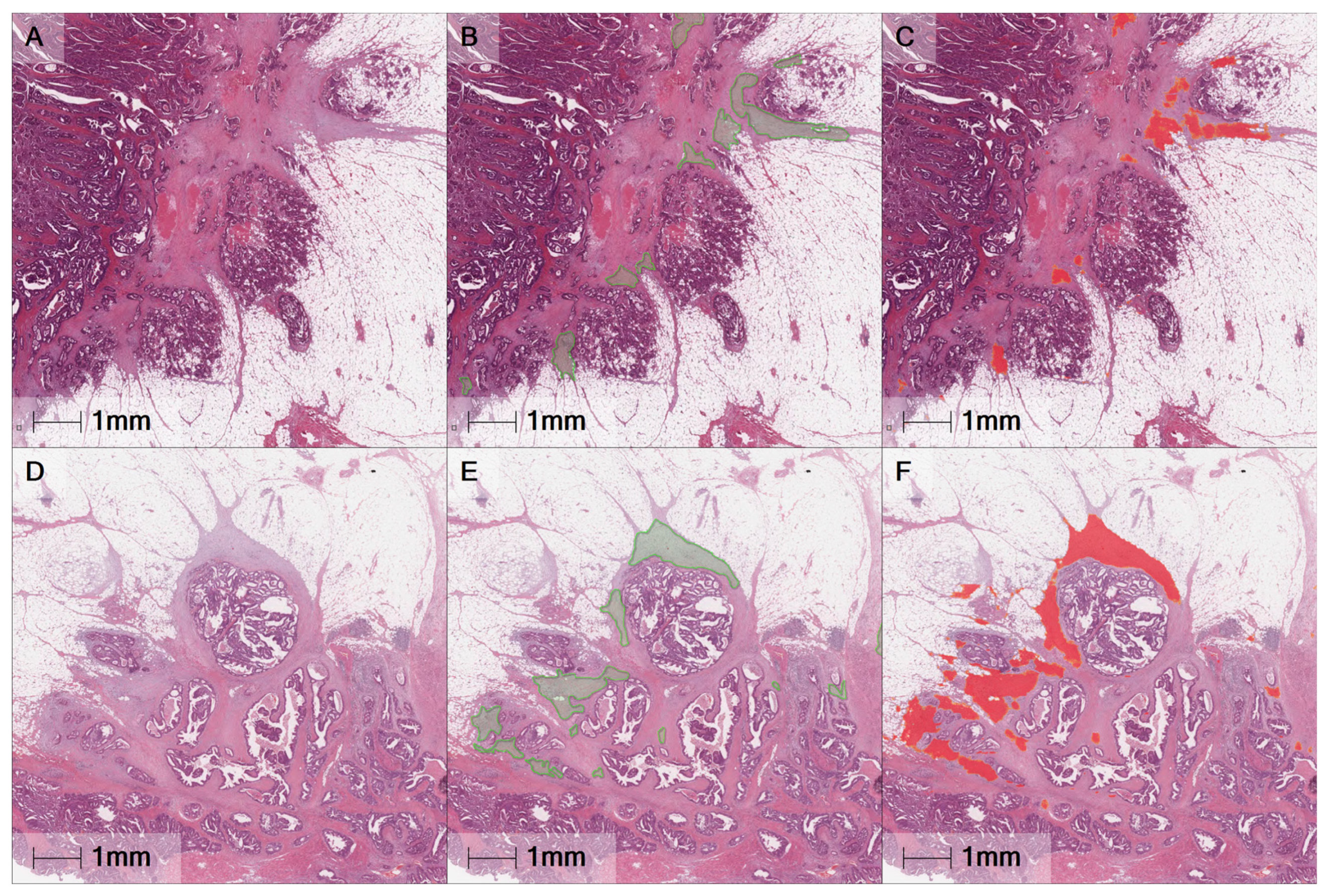 Cancers 13 01615 g001