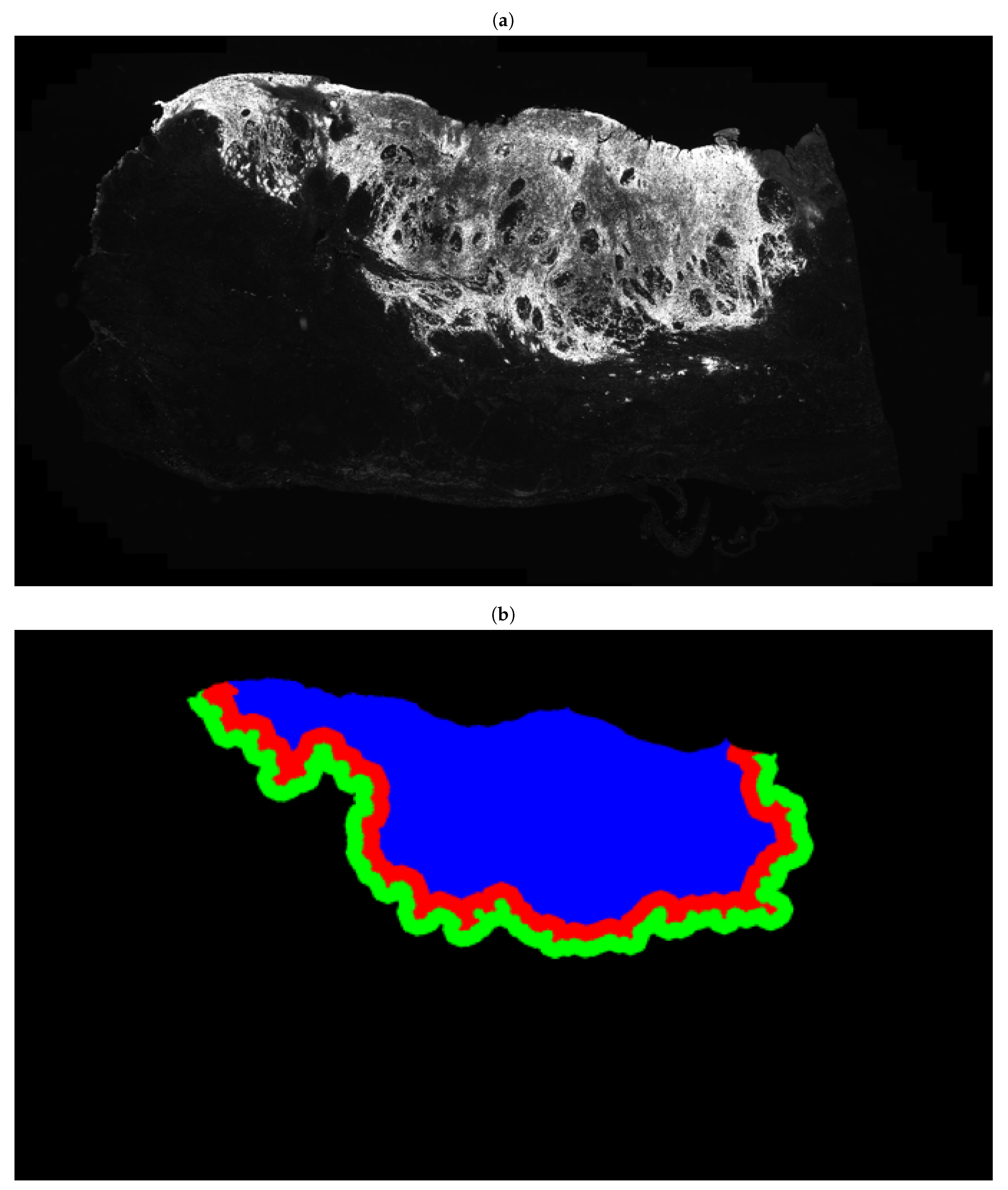 Cancers 13 01624 g005