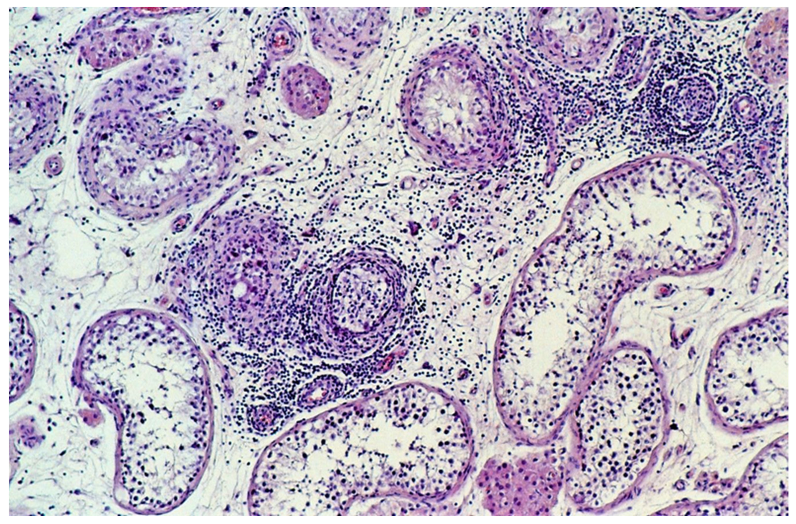 Cancers 13 01652 g001