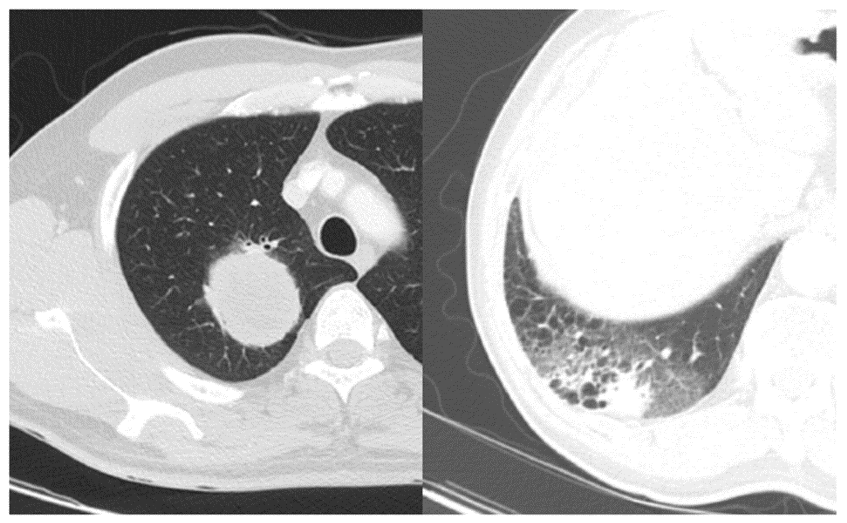 Cancers 13 01676 g002