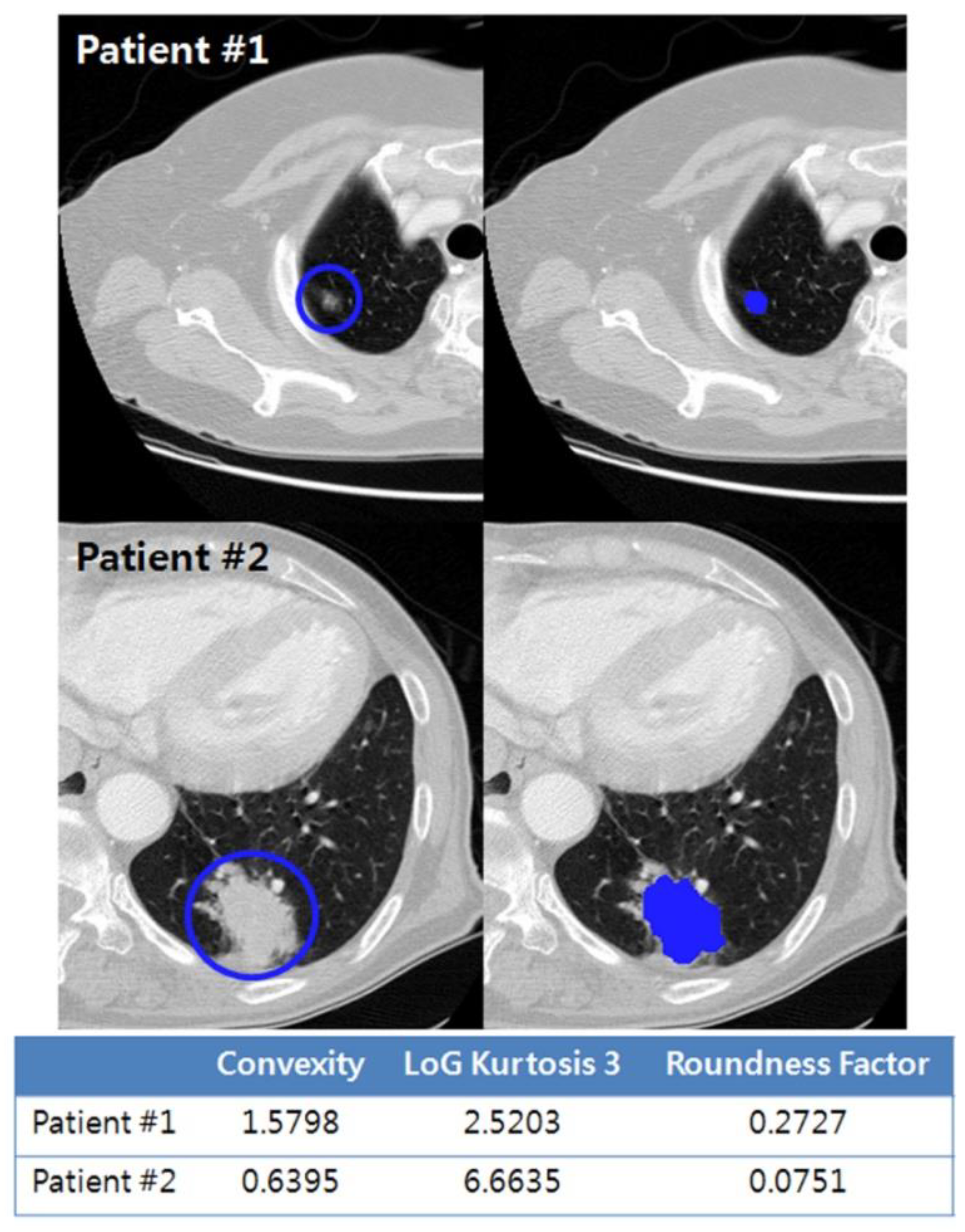 Cancers 13 01676 g005