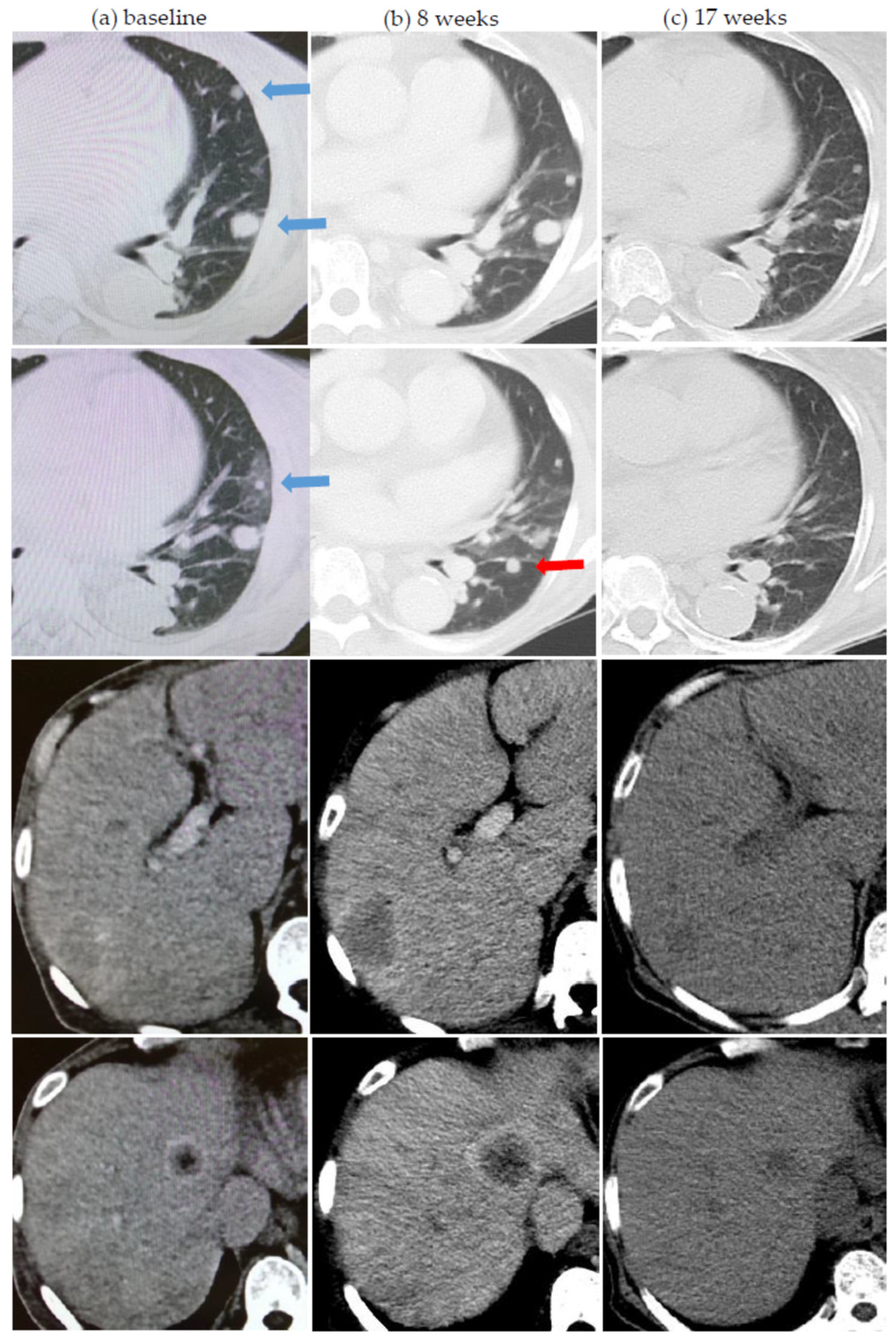 Cancers 13 01689 g001