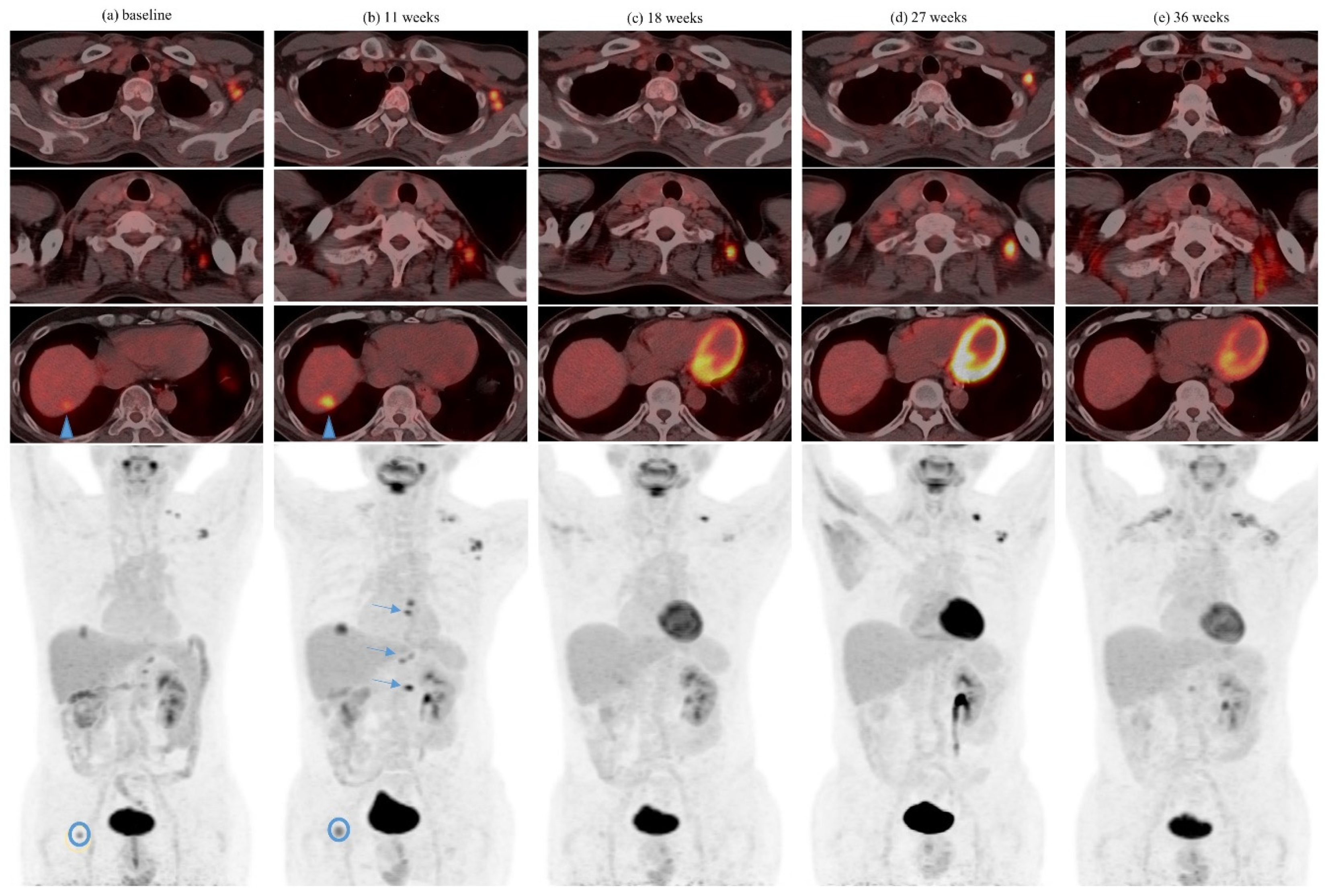 Cancers 13 01689 g002