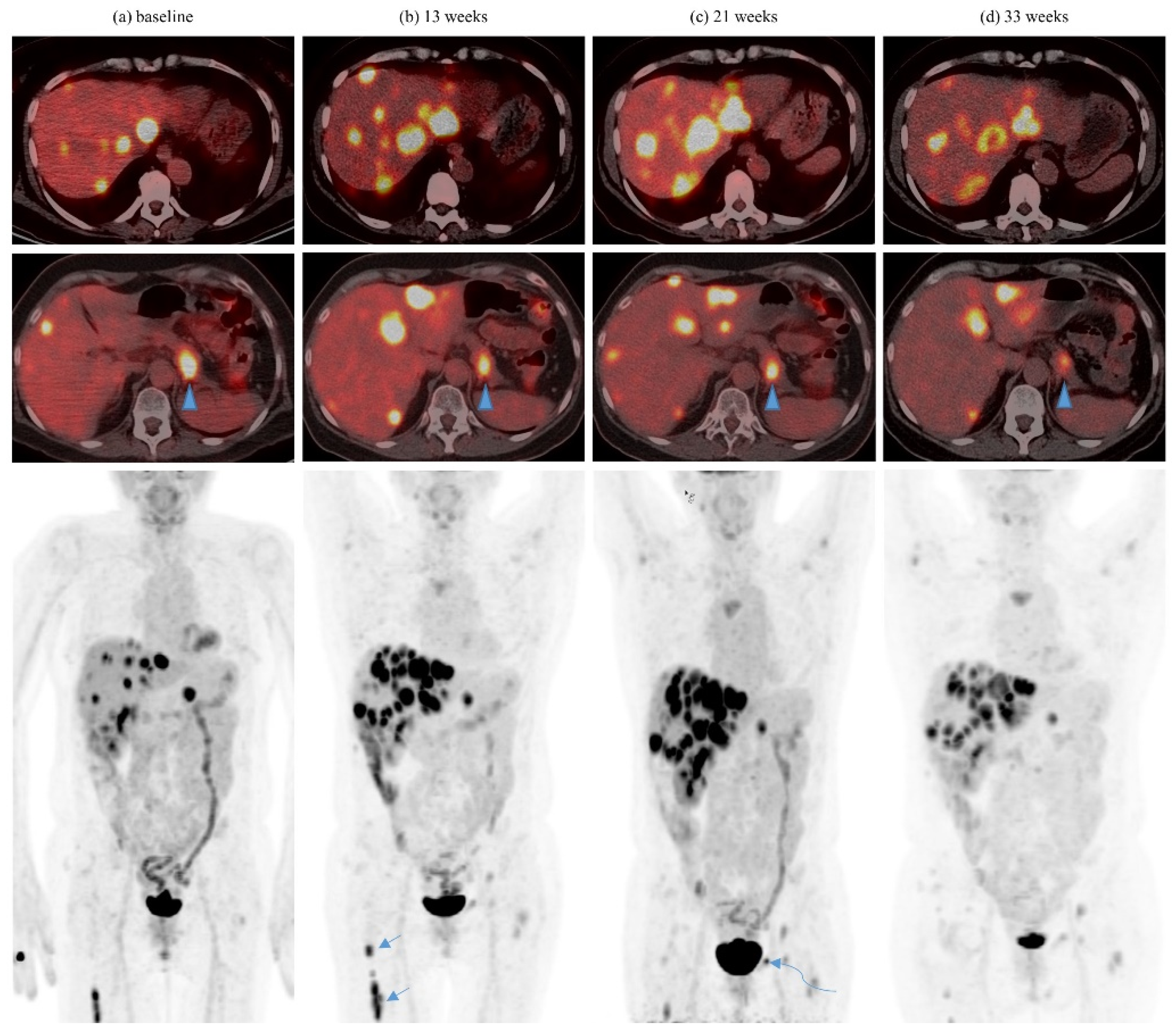 Cancers 13 01689 g003