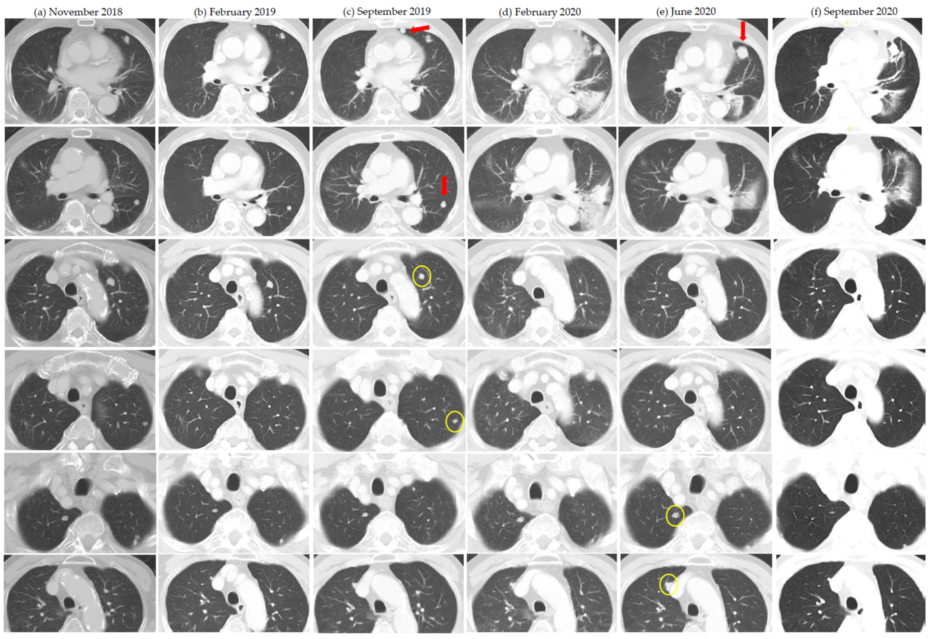 Cancers 13 01689 g004