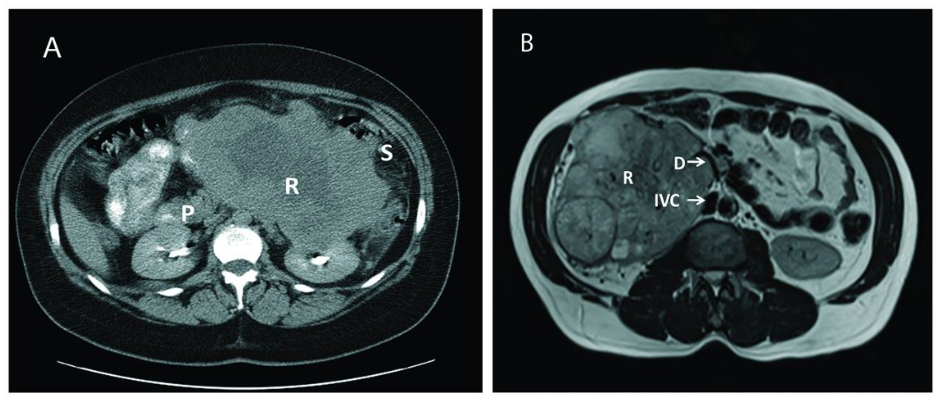 Cancers 13 01695 g001