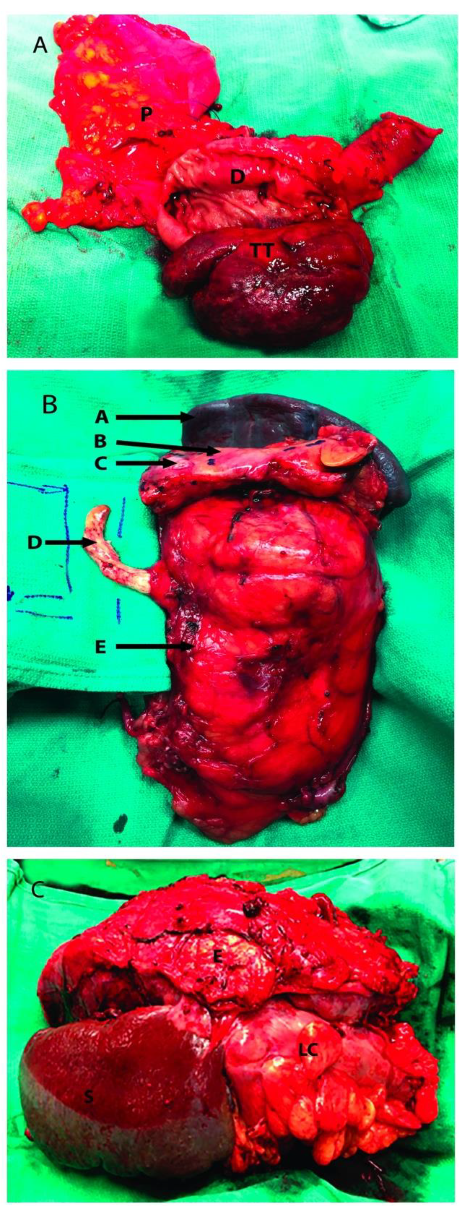 Cancers 13 01695 g002