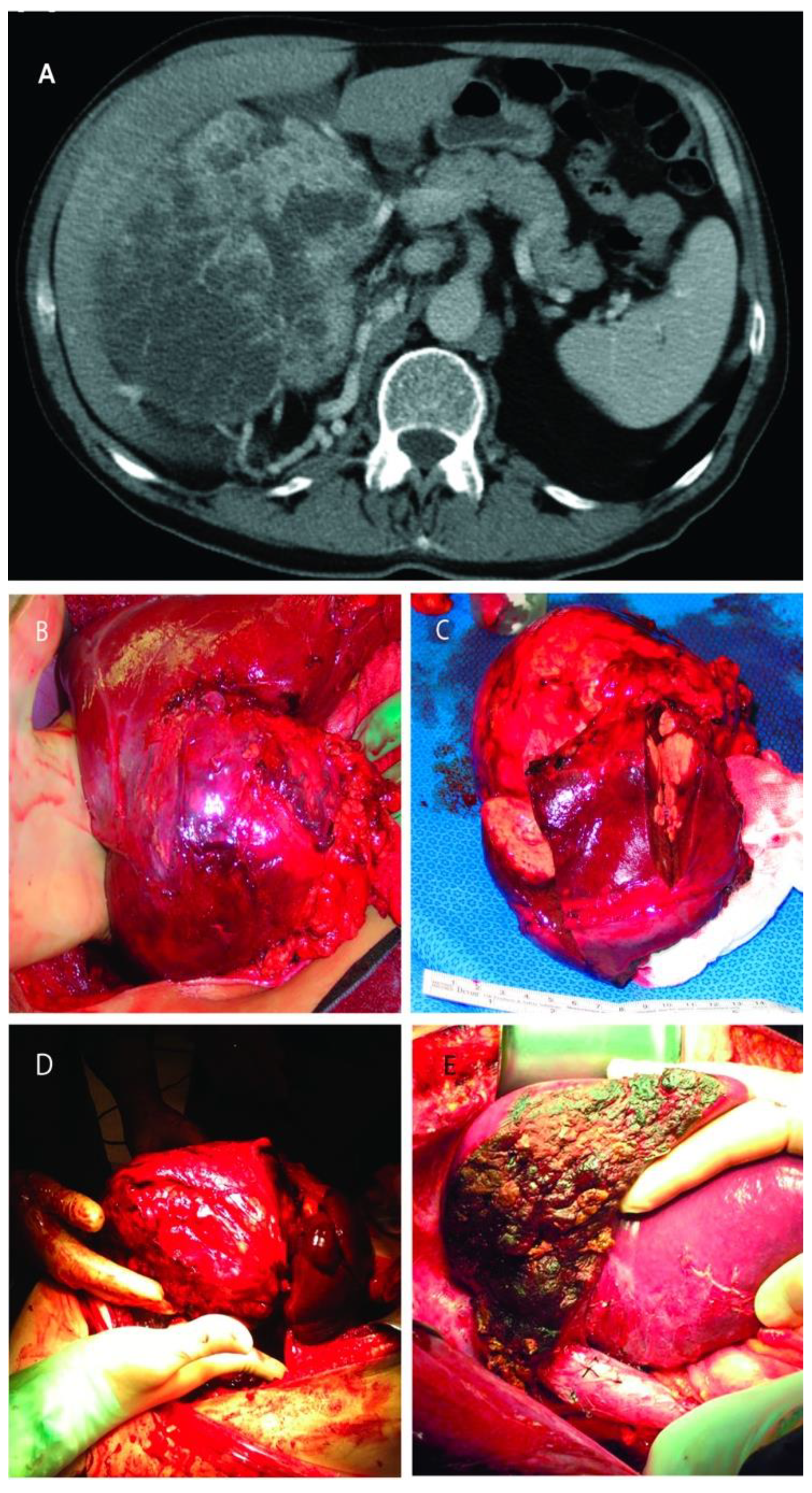 Cancers 13 01695 g003