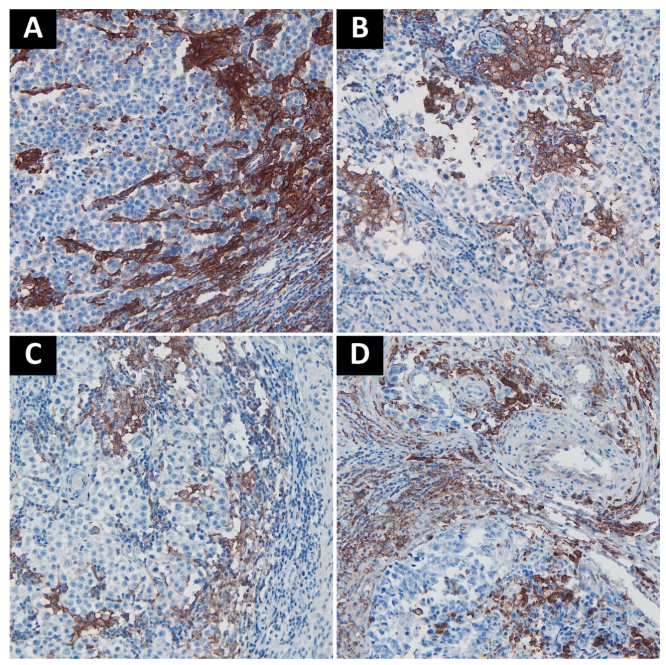 Cancers 13 01750 g002