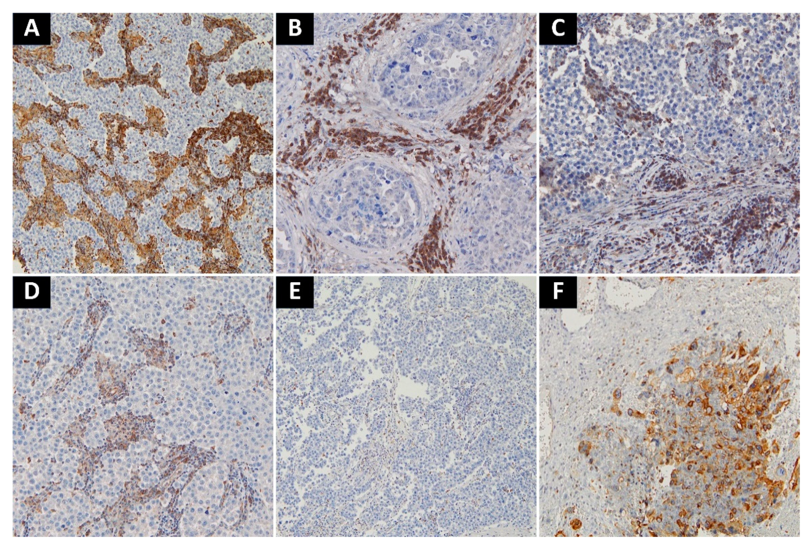 Cancers 13 01750 g003