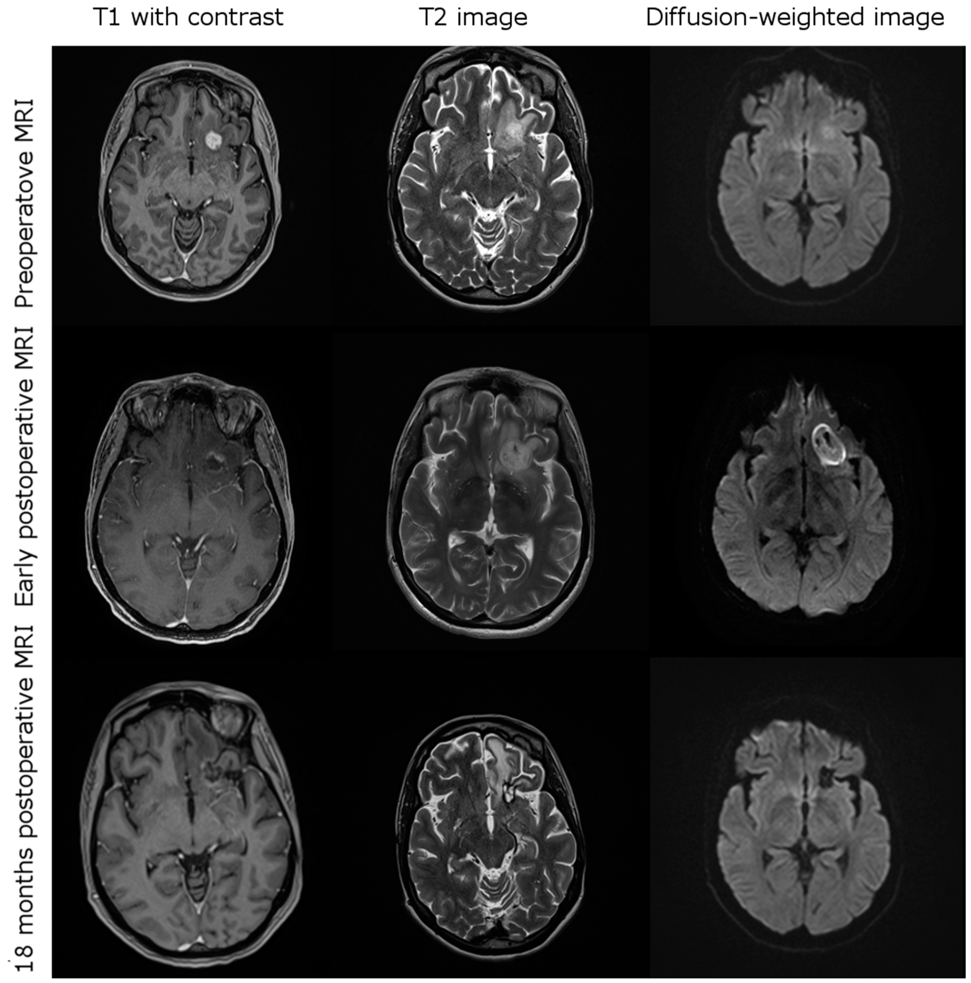 Cancers 13 01767 g001