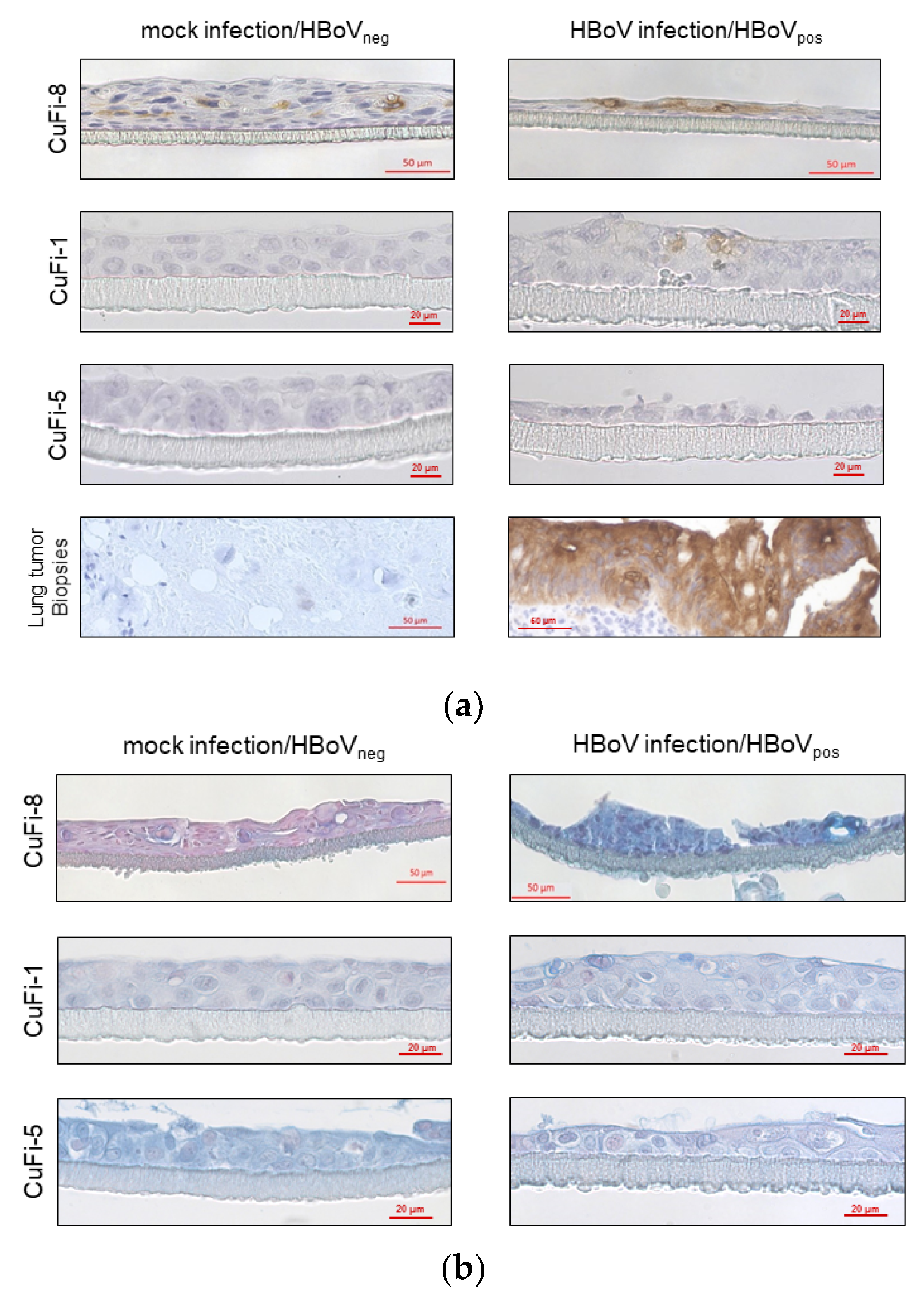 Cancers 13 01774 g004