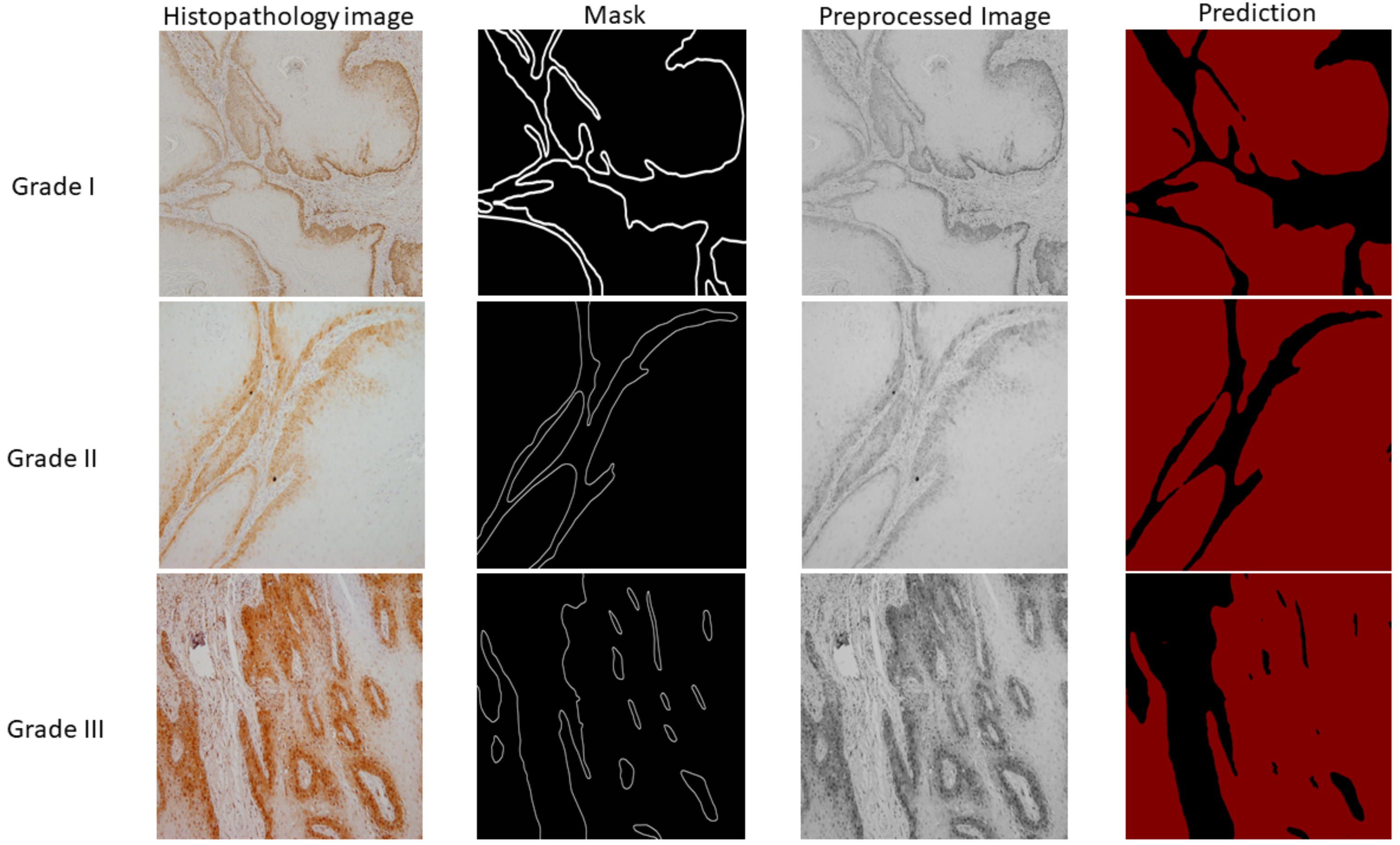 Cancers 13 01784 g010 Cancers 13 01784 g010