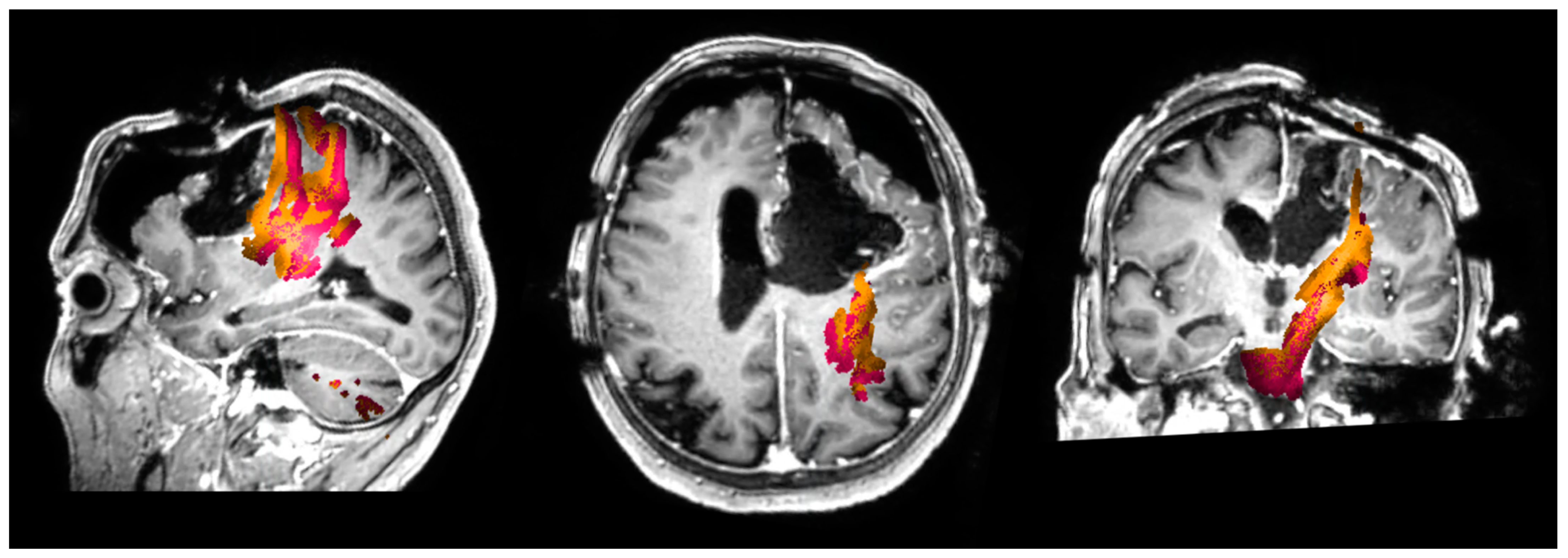 Cancers 13 01787 g001