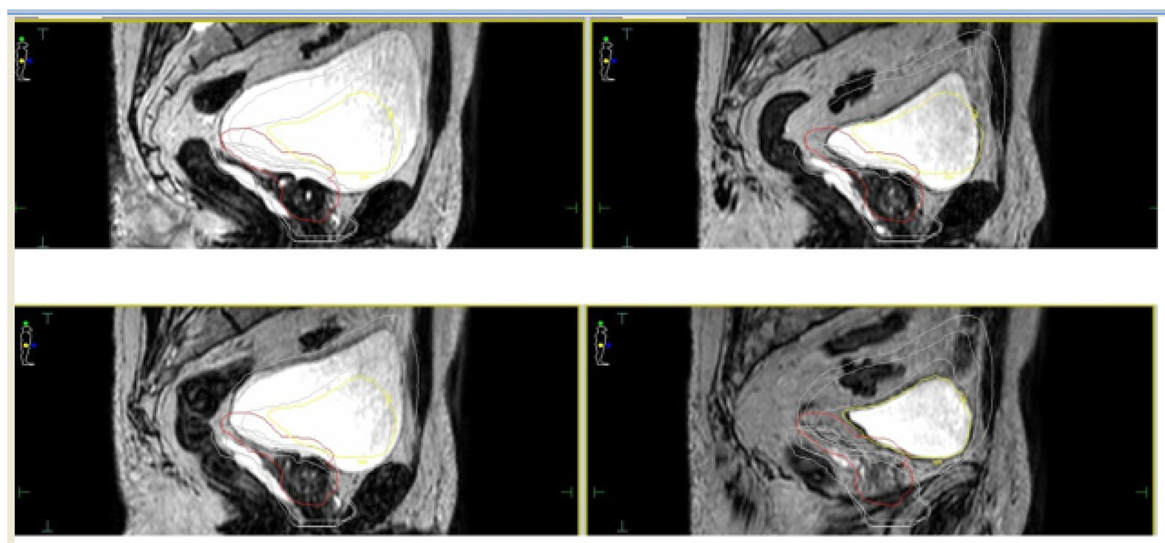 Cancers 13 01791 g002