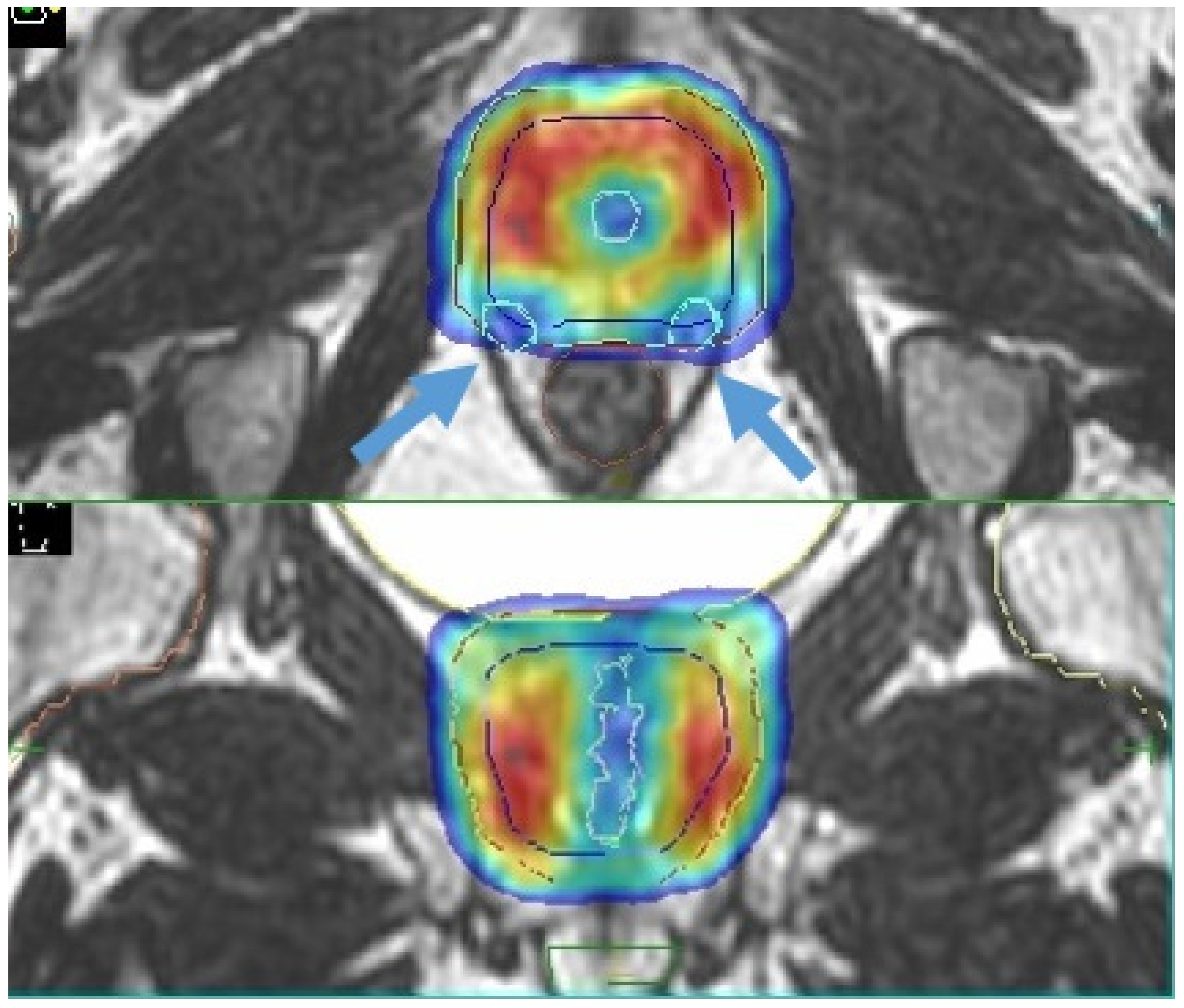 Cancers 13 01791 g004