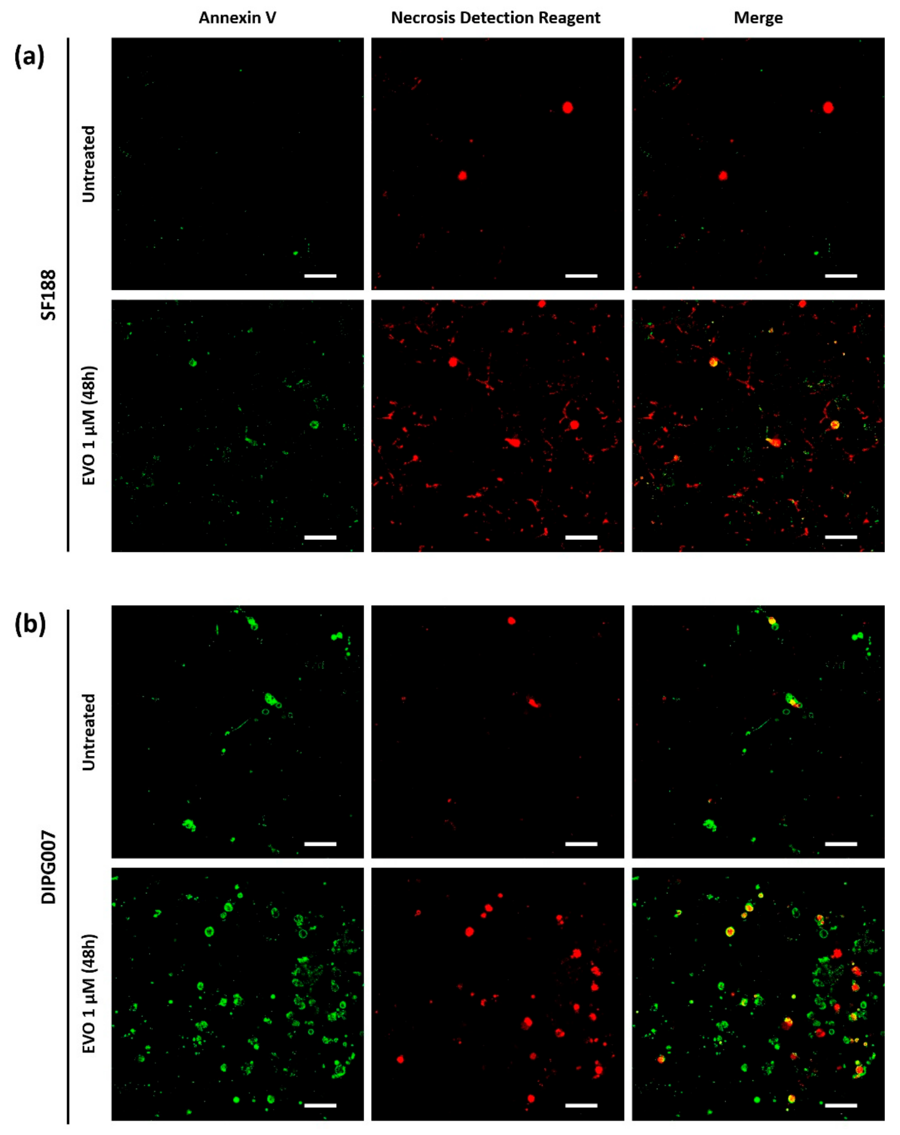 Cancers 13 01804 g002a Cancers 13 01804 g002a