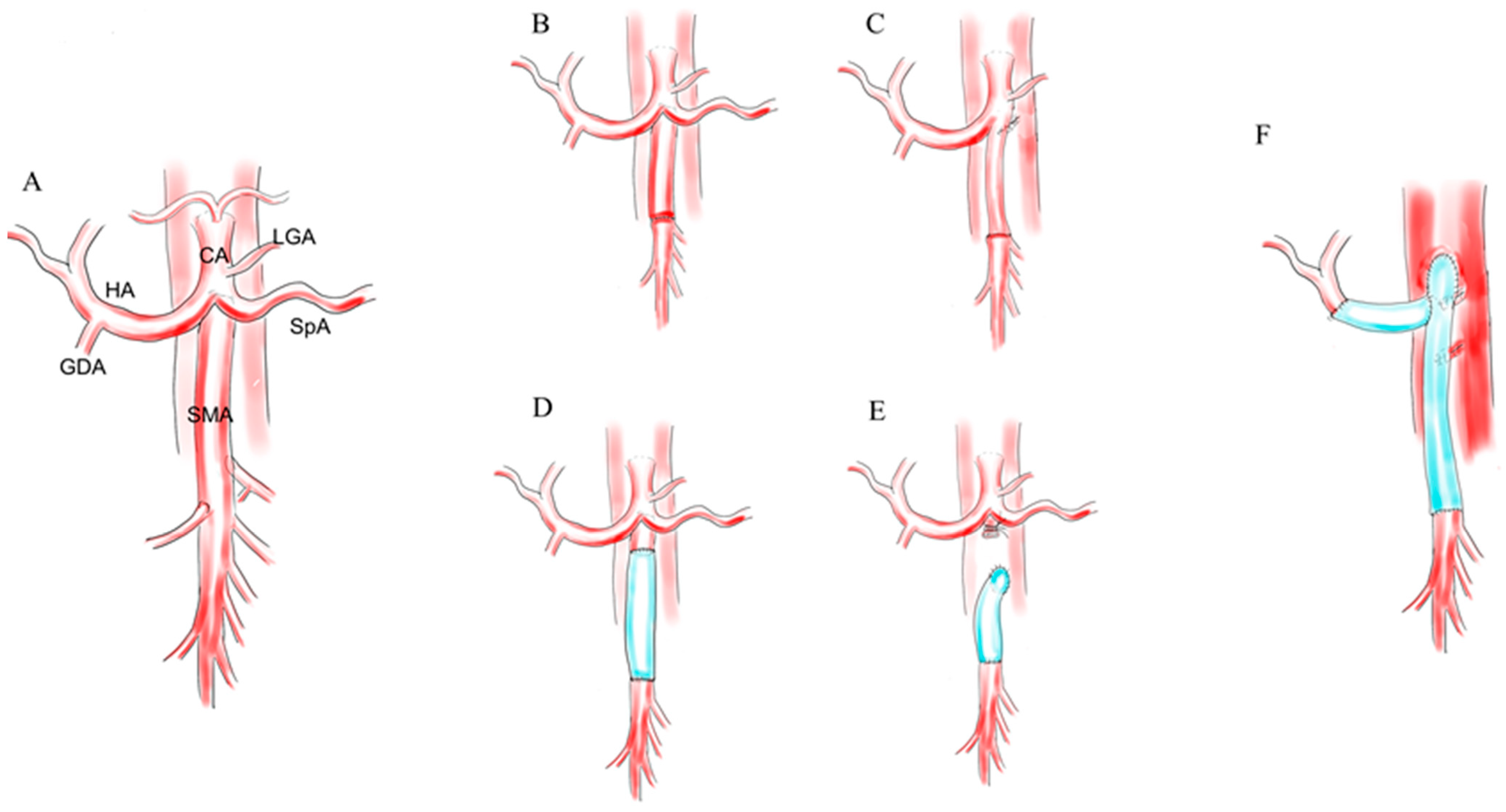 Cancers 13 01818 g001