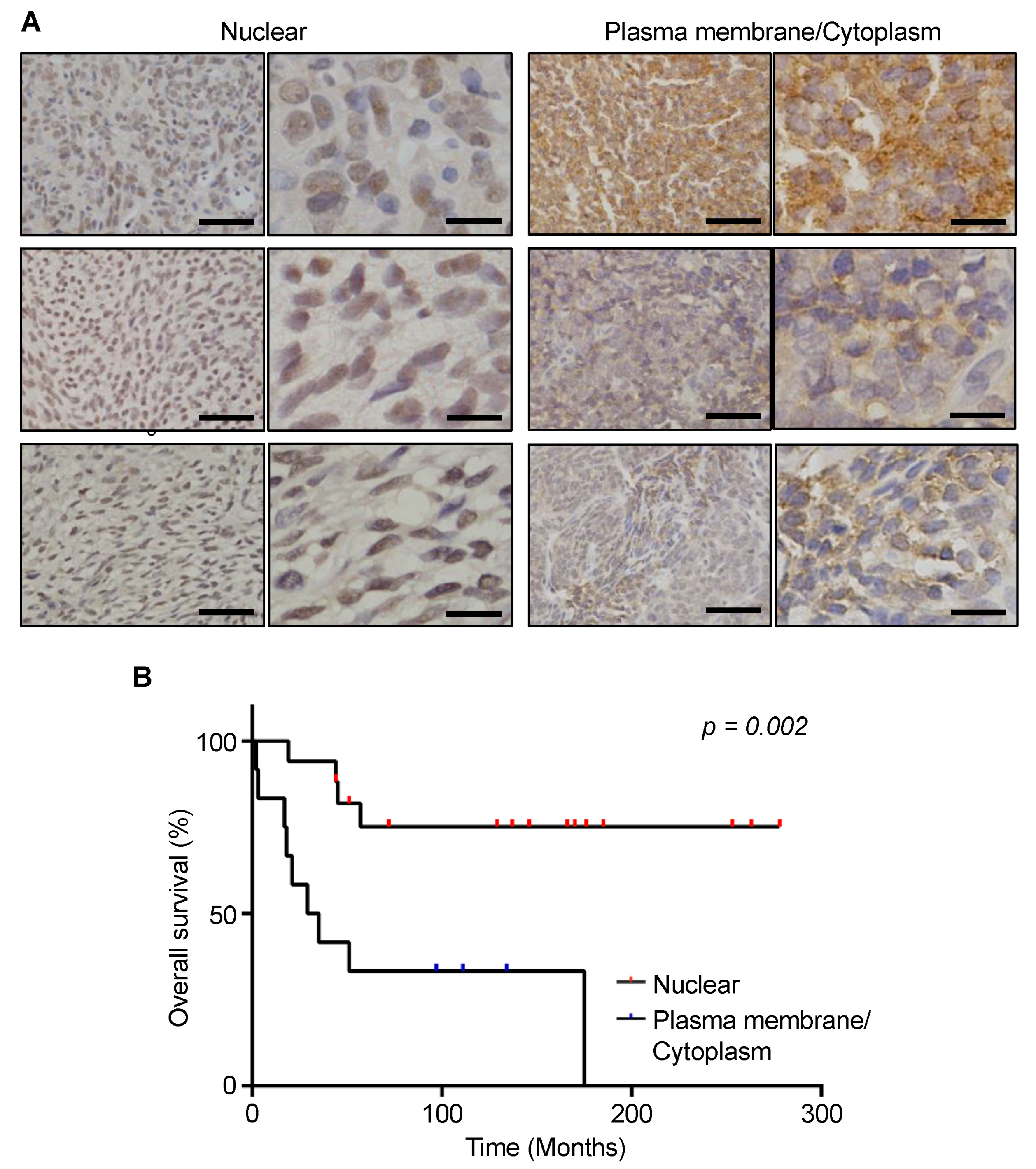 Cancers 13 01823 g004