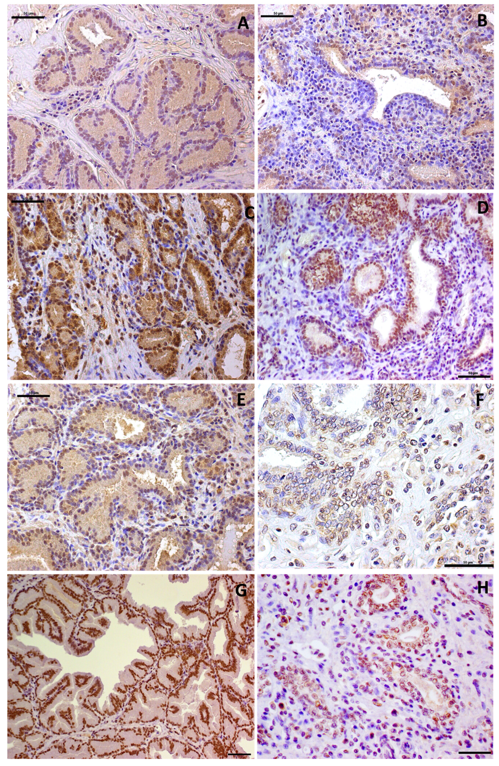 Cancers 13 01887 g004