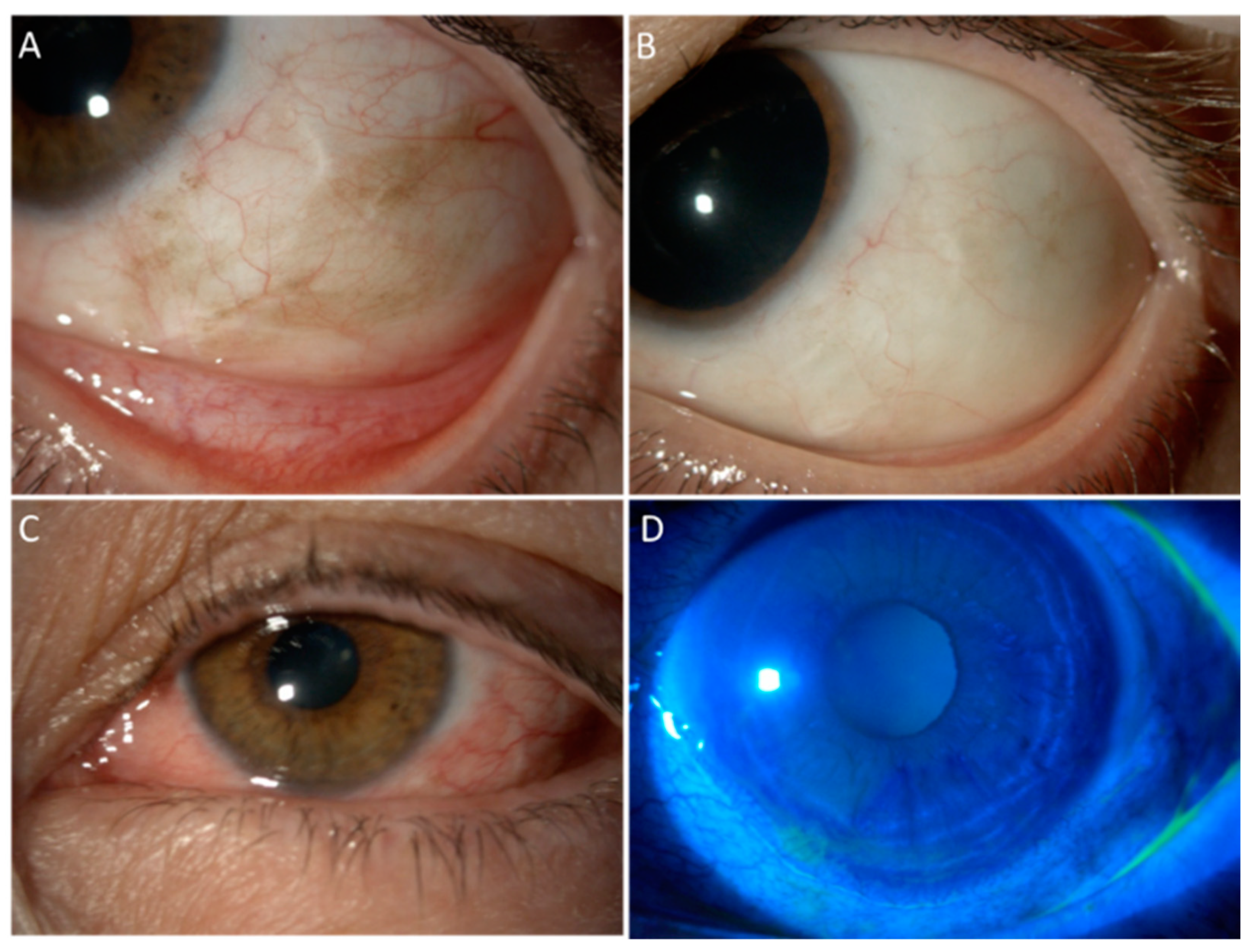 Cancers 13 01933 g001