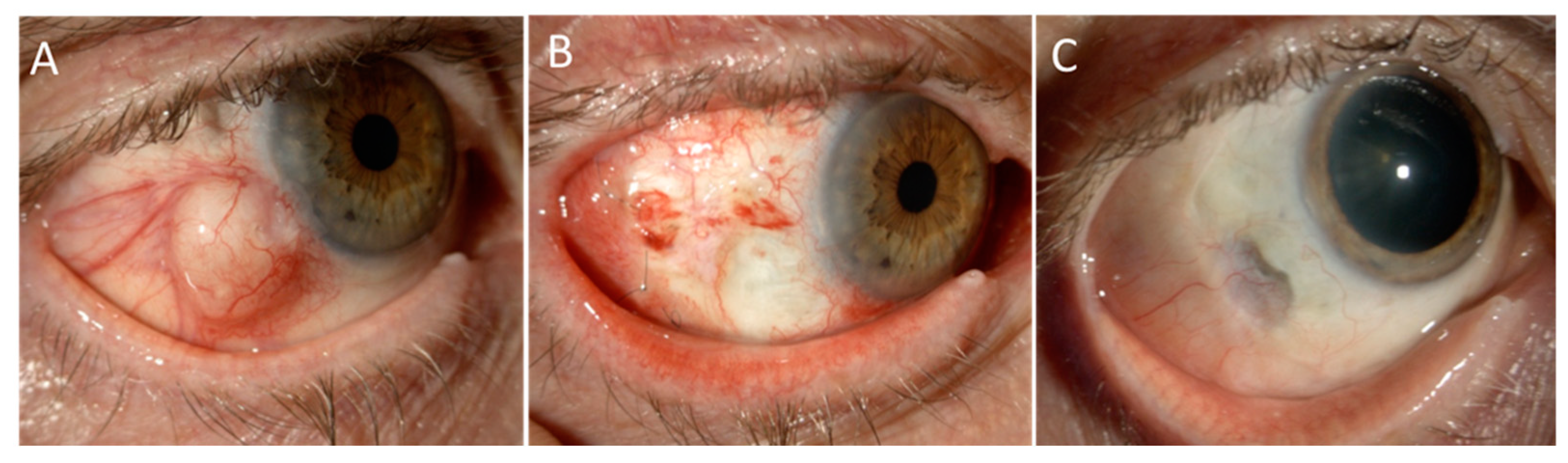 Cancers 13 01933 g004