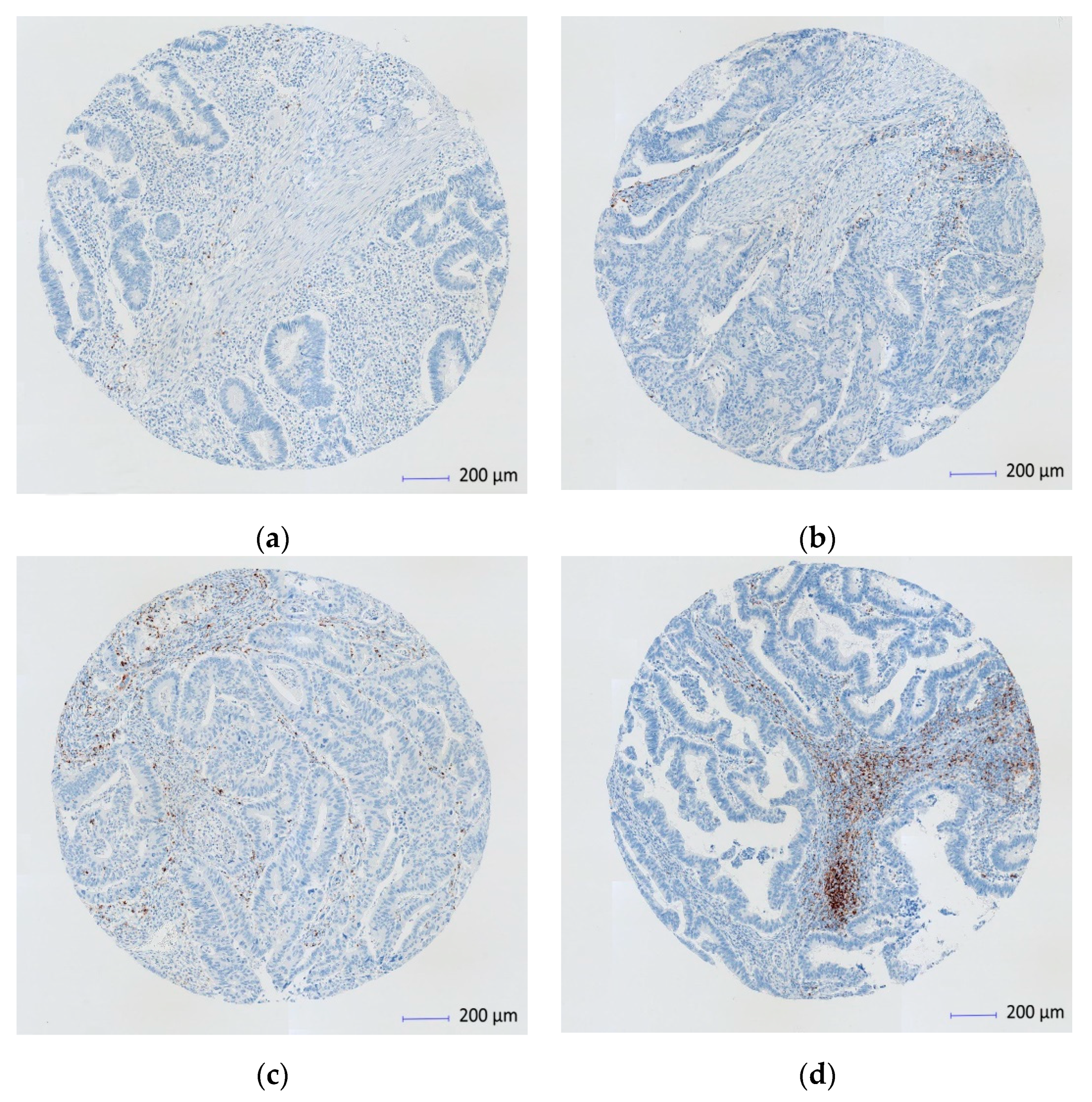 Cancers 13 01943 g001 Cancers 13 01943 g001