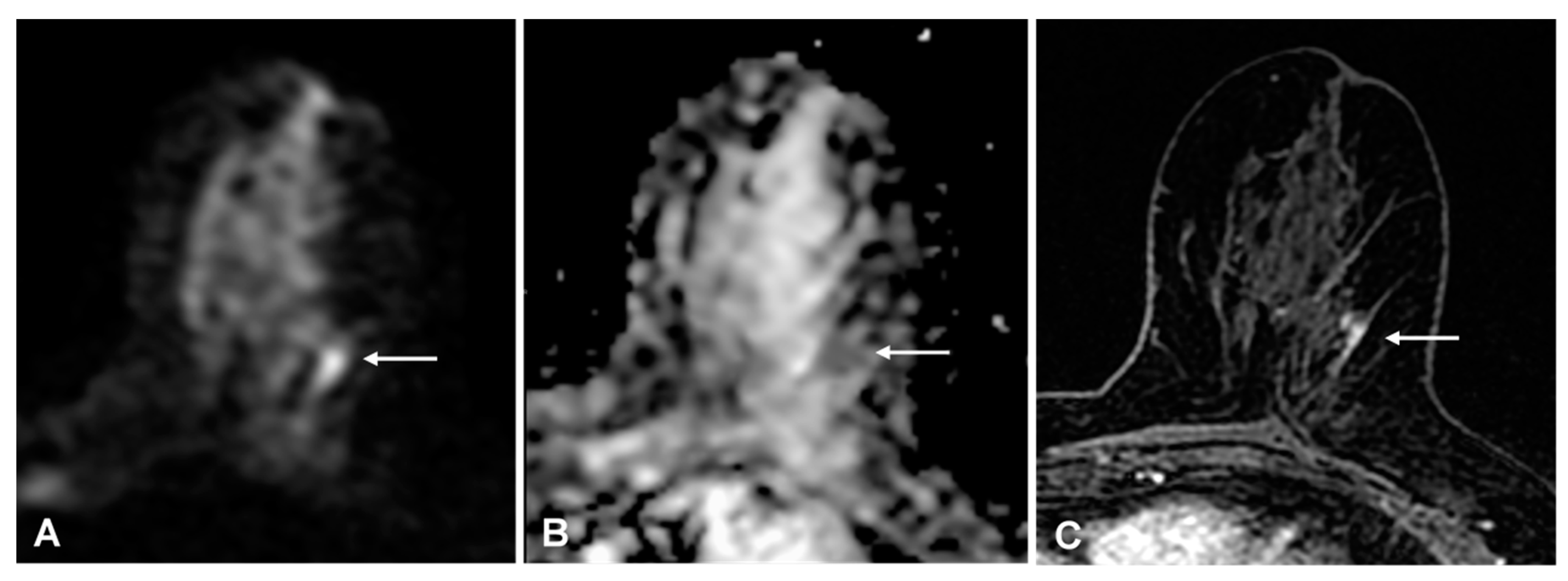 Cancers 13 01978 g004