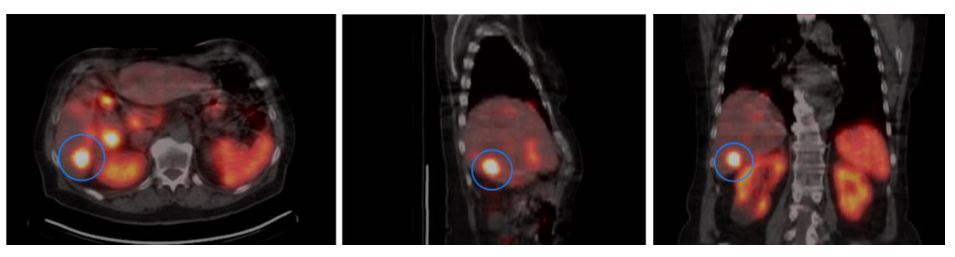 Cancers 13 02035 g002