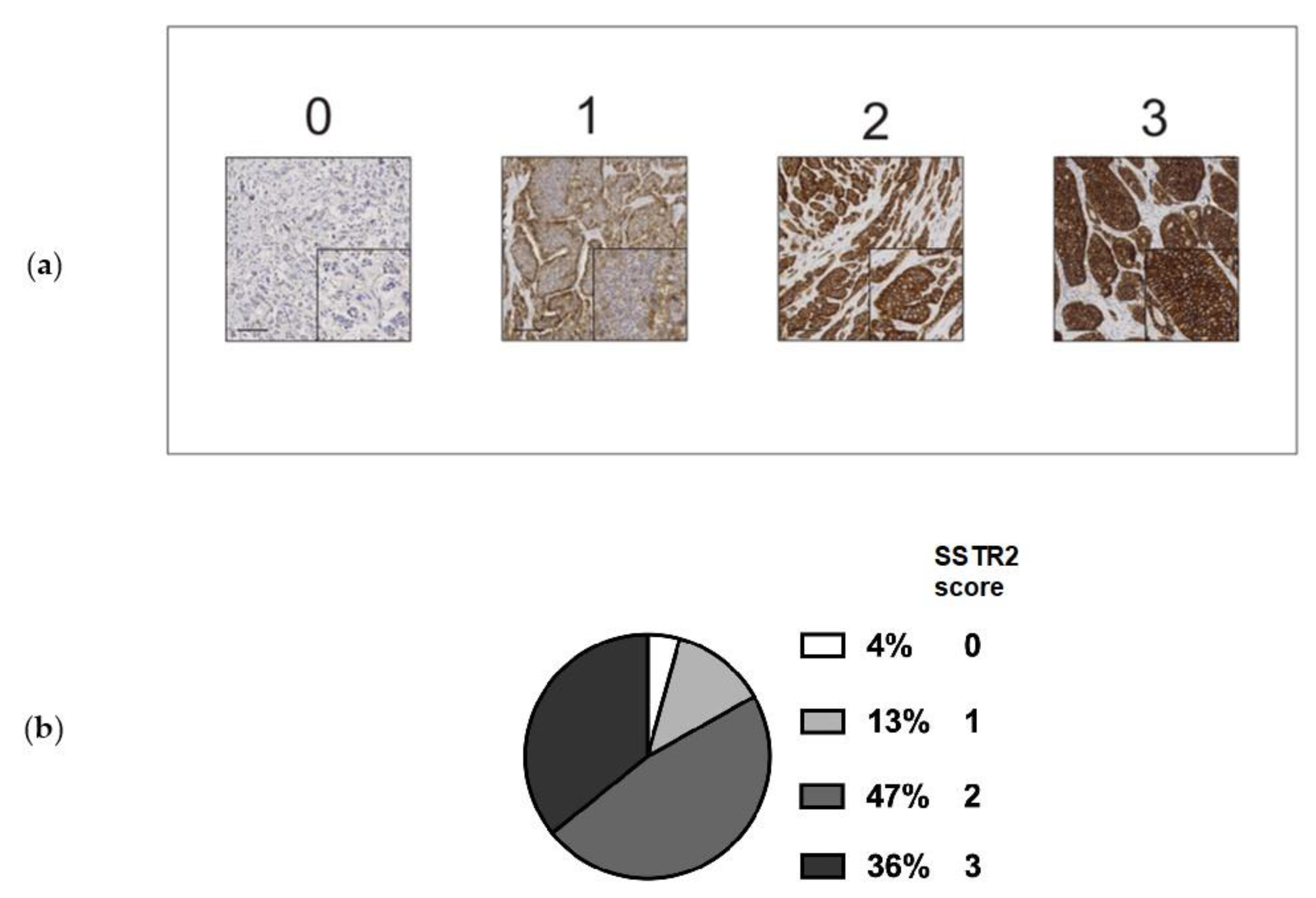 Cancers 13 02035 g003