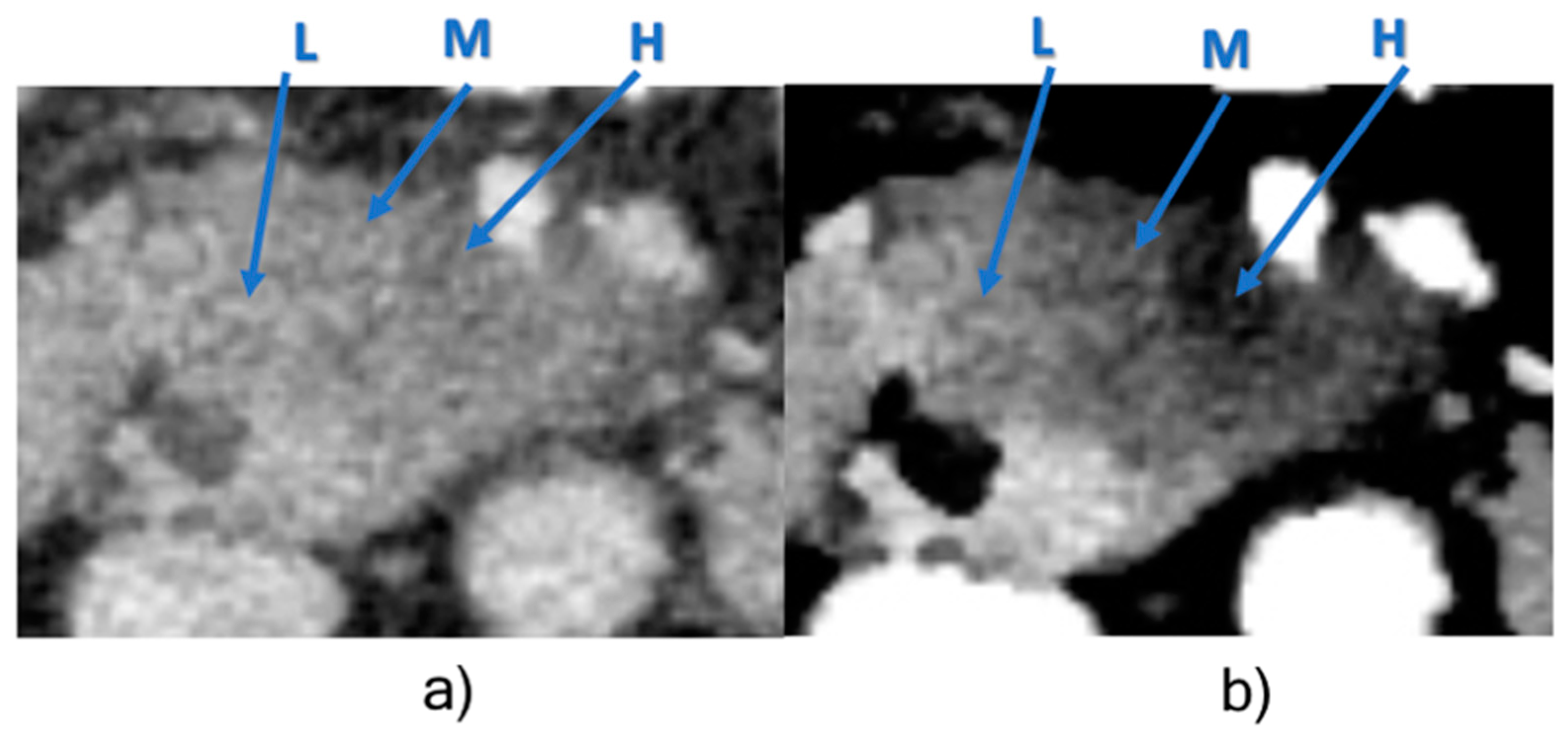 Cancers 13 02069 g002