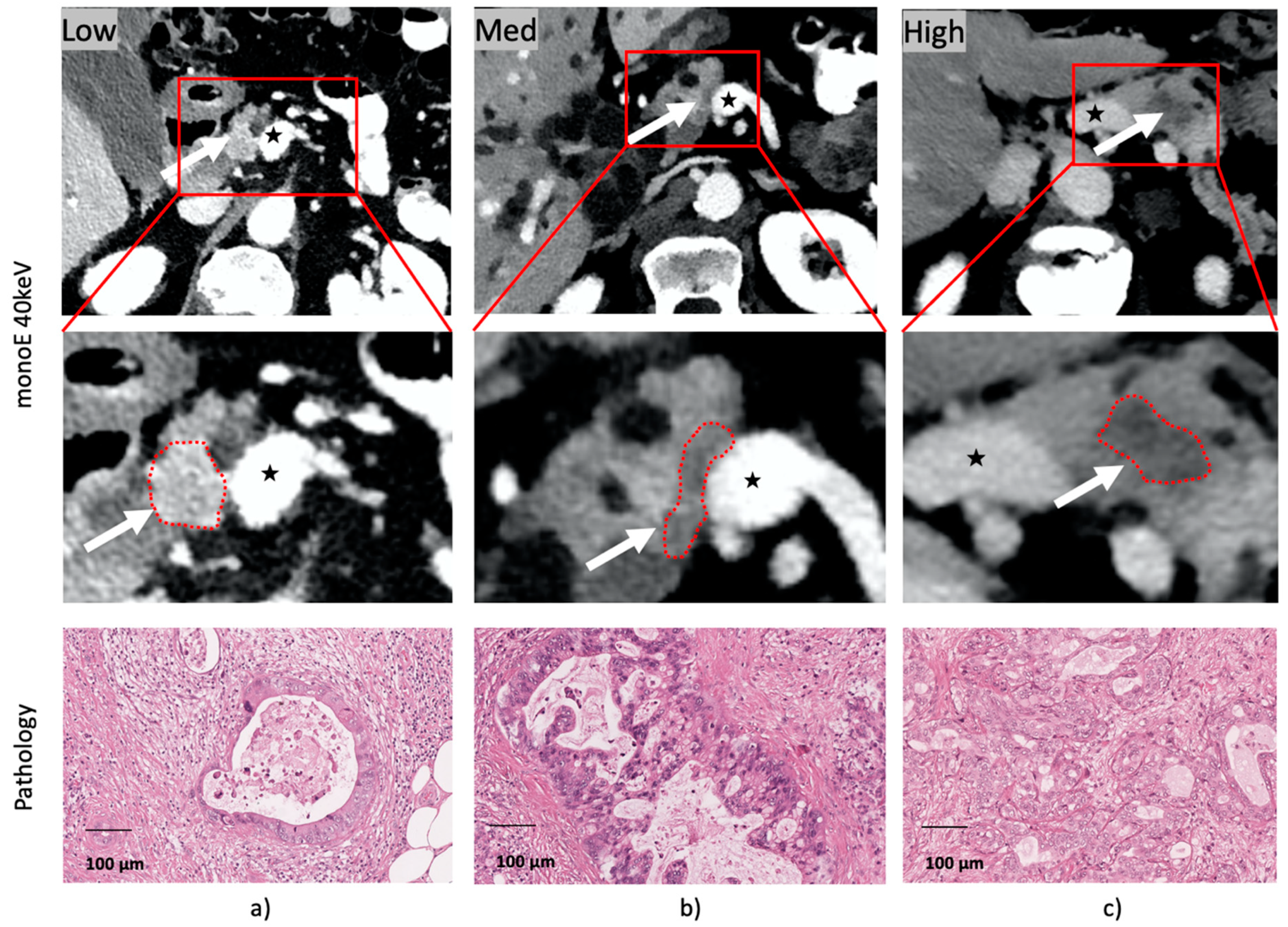 Cancers 13 02069 g003